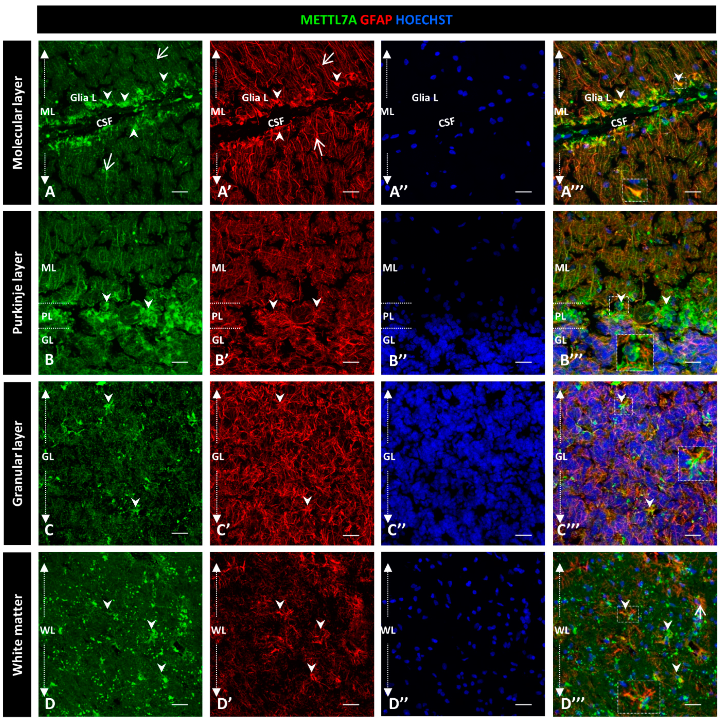 Ijms 24 08405 g003 Ijms 24 08405 g003