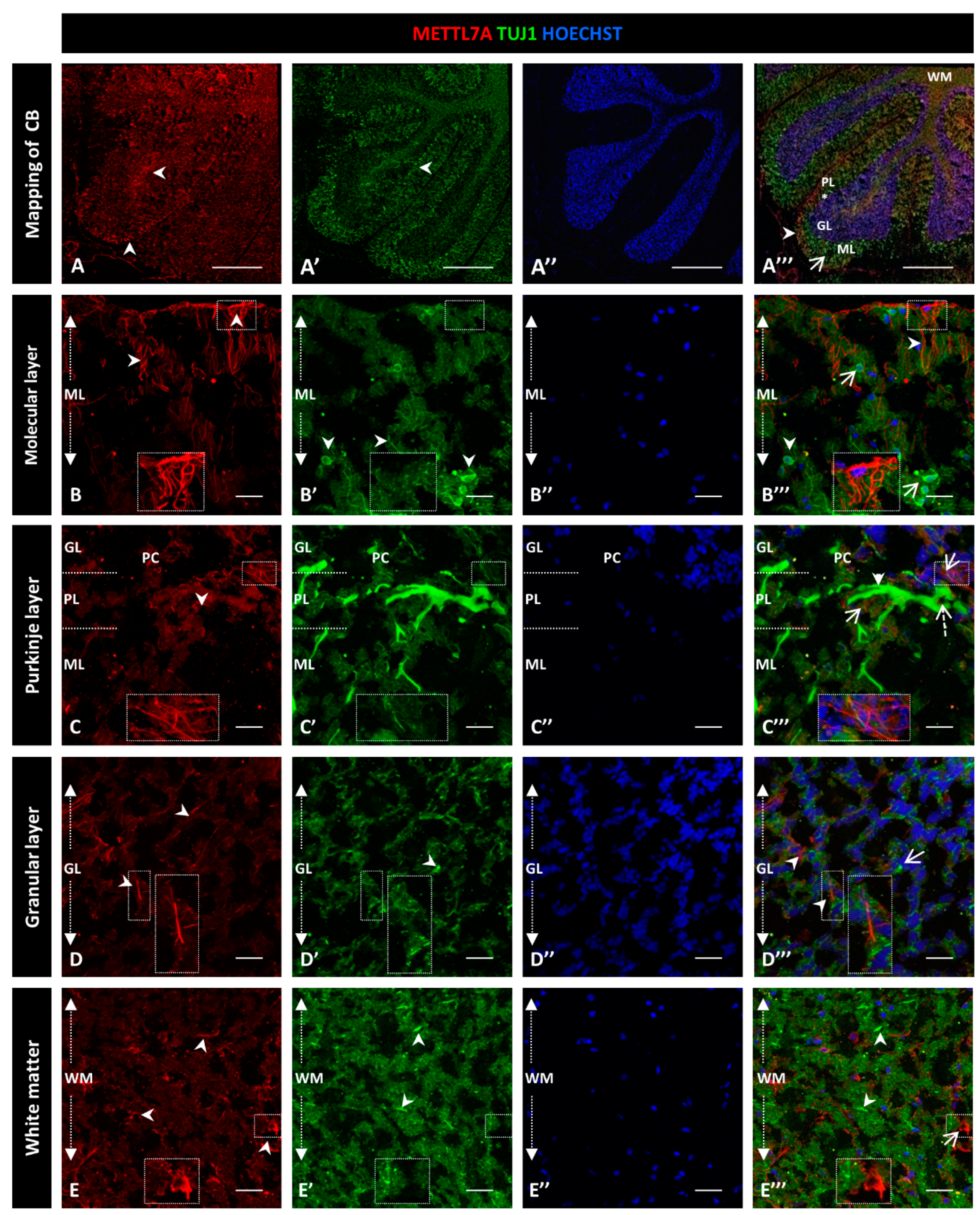 Ijms 24 08405 g004 Ijms 24 08405 g004