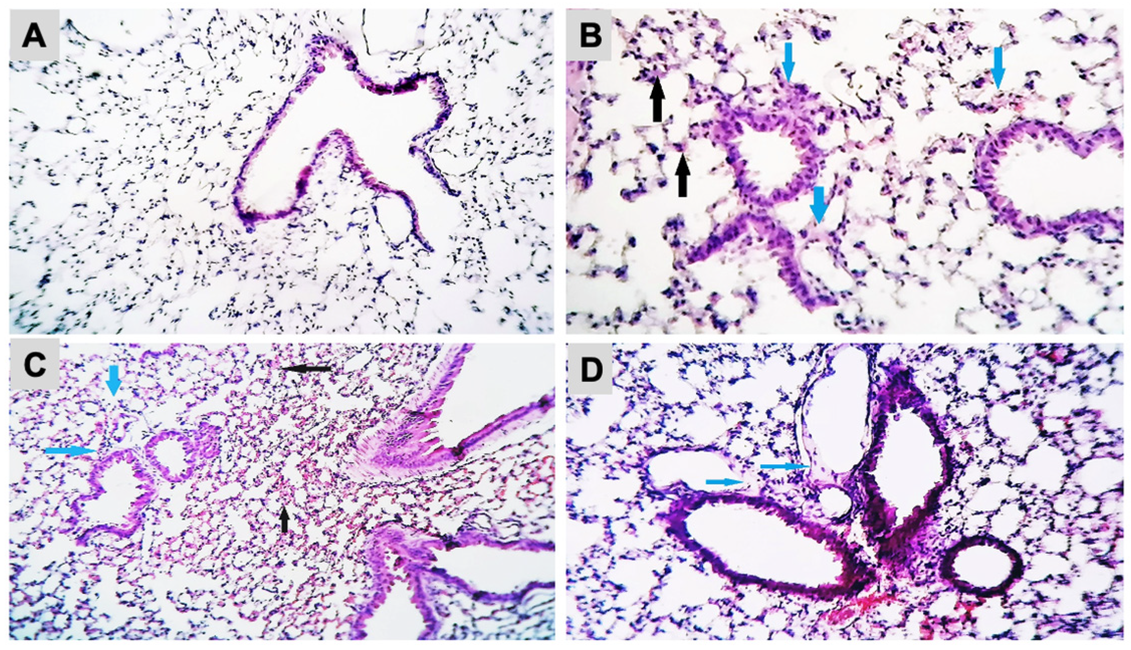 Ijms 24 09895 g003 Ijms 24 09895 g003