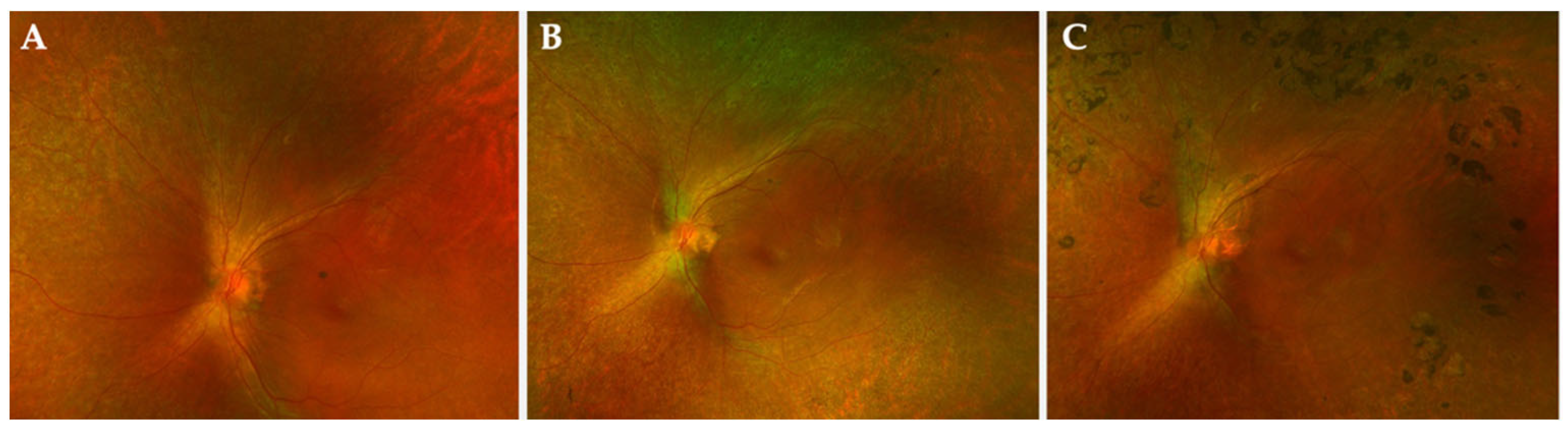 Ijms 24 10535 g004 Ijms 24 10535 g004