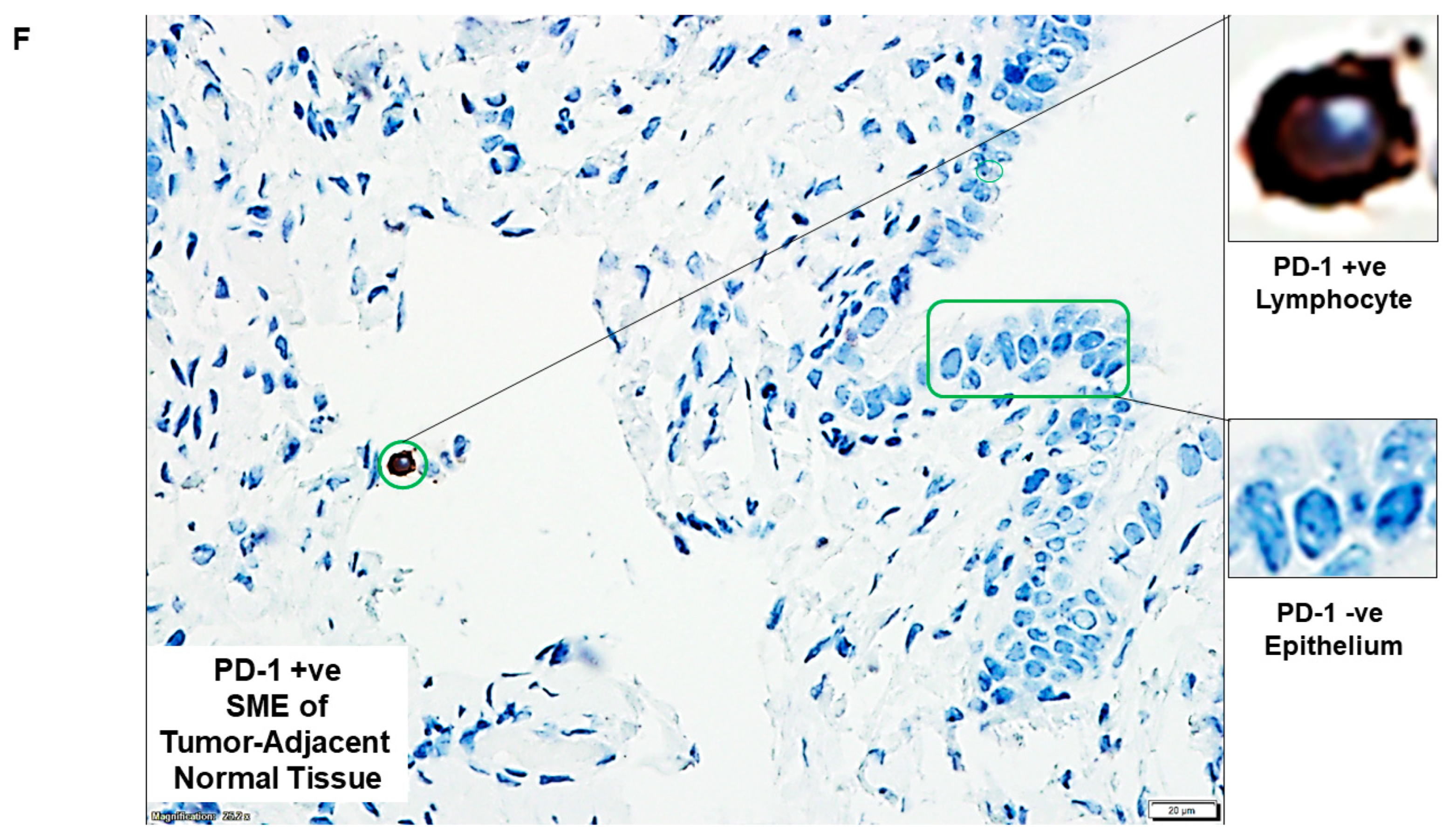 Ijms 24 11079 g002d Ijms 24 11079 g002d