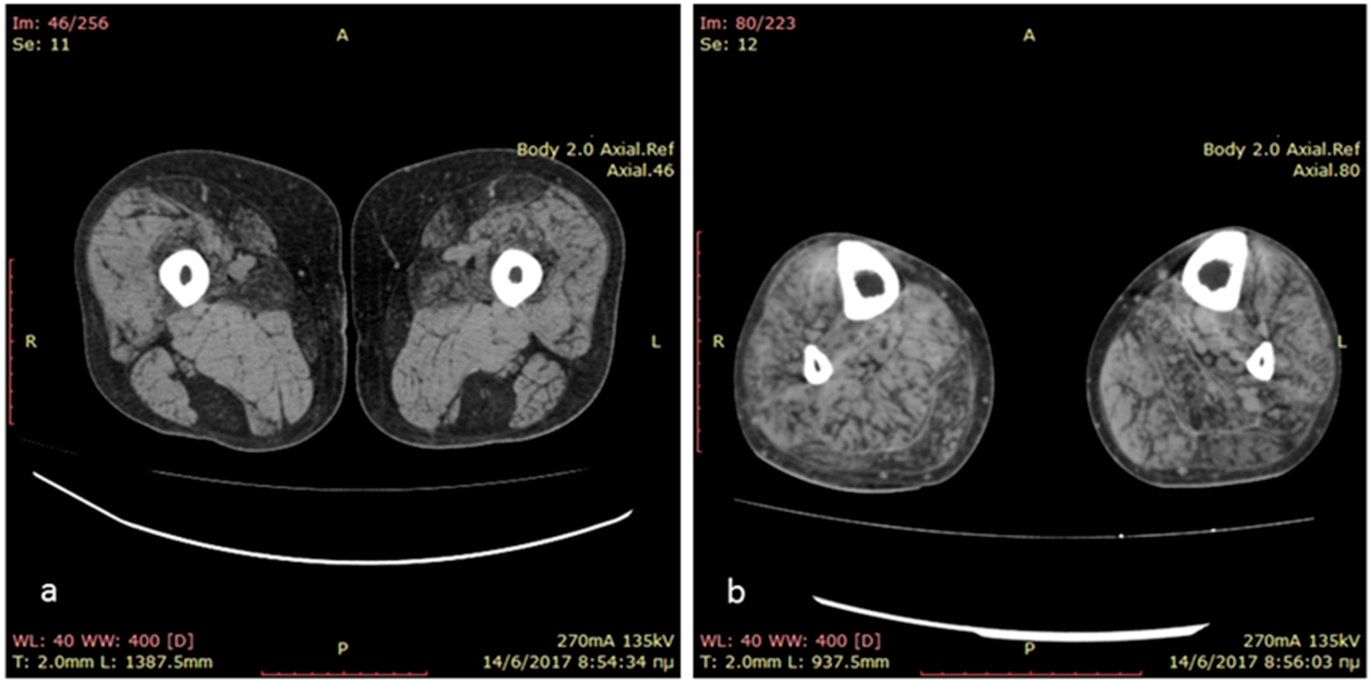 Ijms 24 11181 g001 Ijms 24 11181 g001
