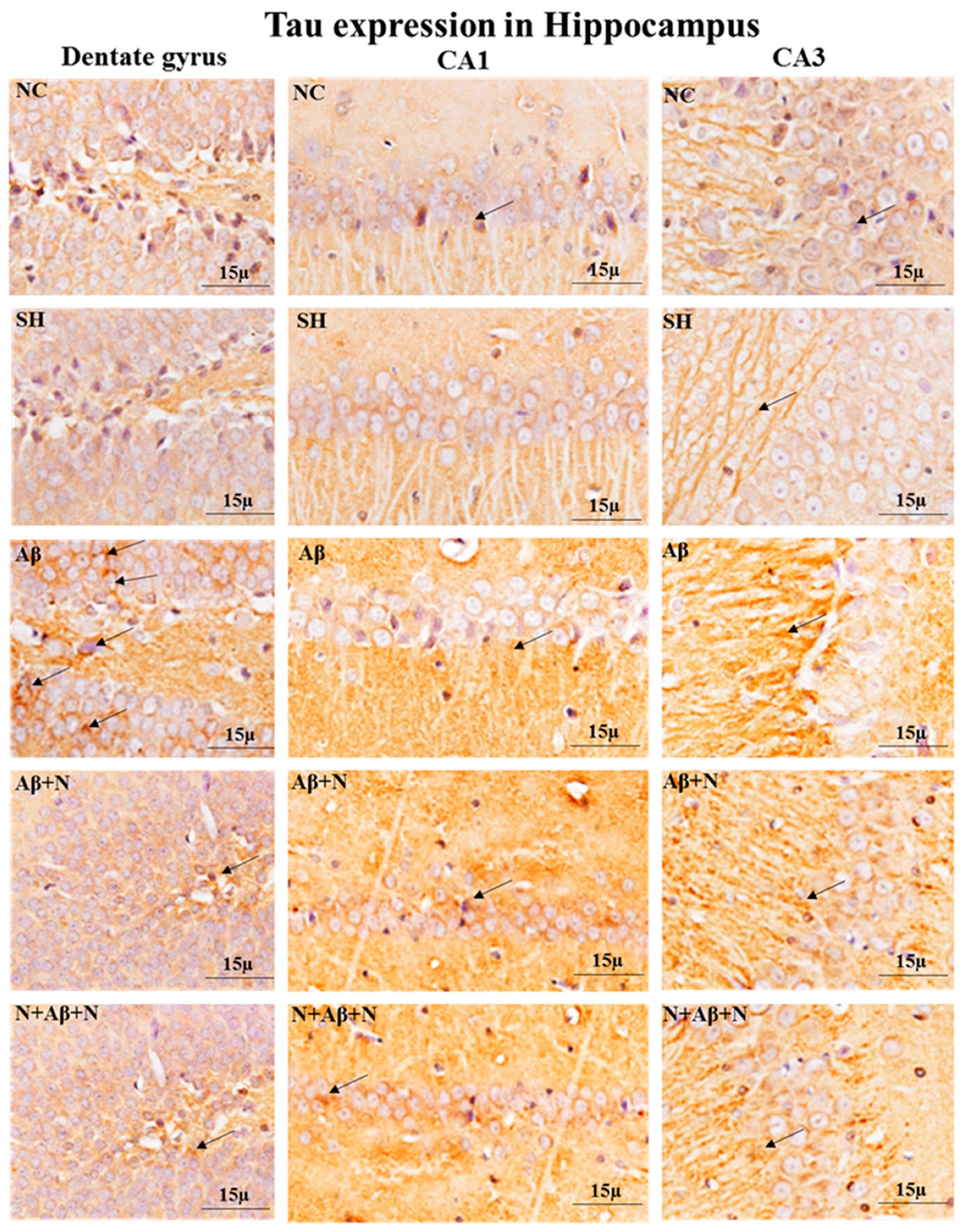 Ijms 24 12733 g010 Ijms 24 12733 g010