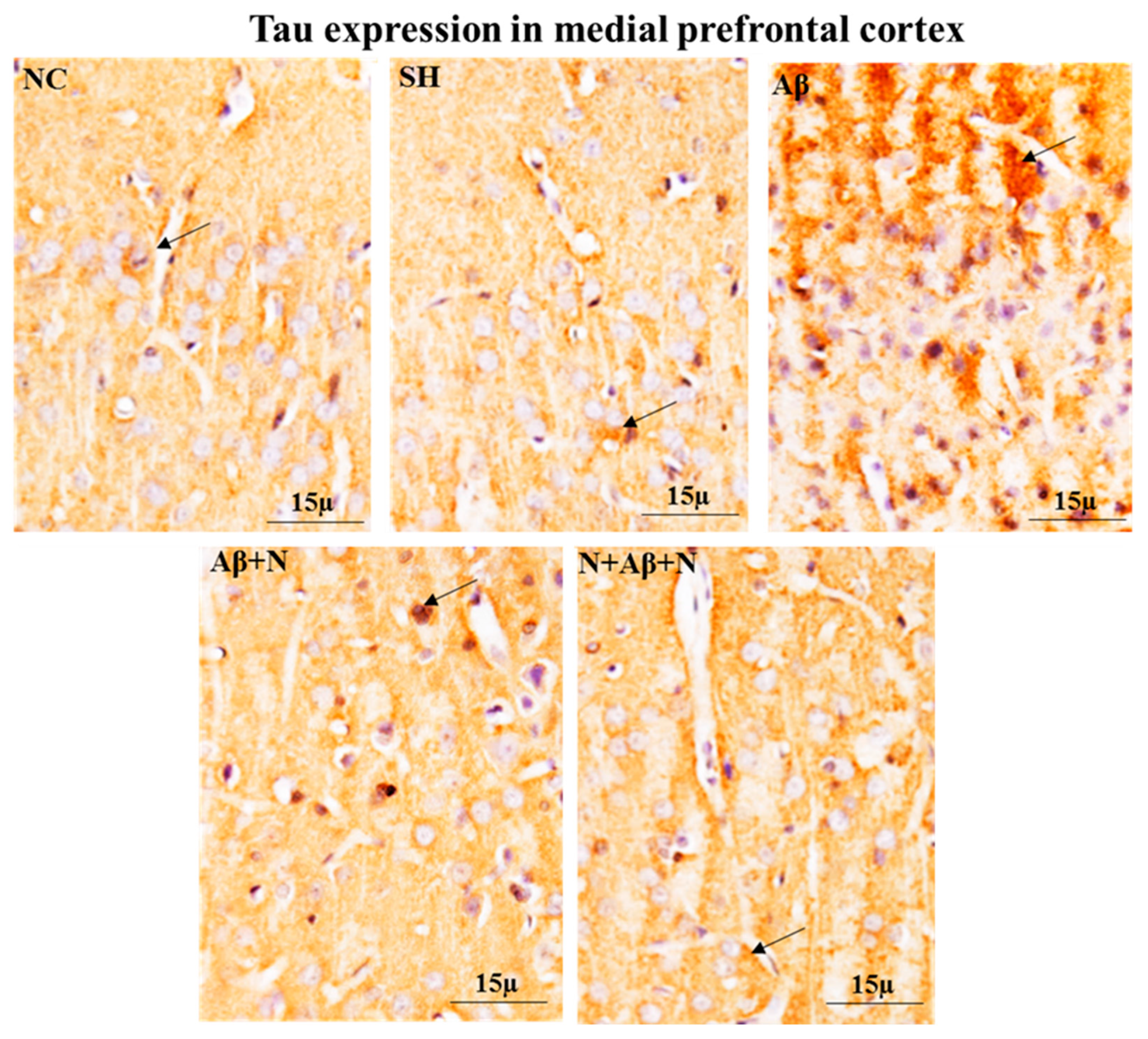 Ijms 24 12733 g011 Ijms 24 12733 g011