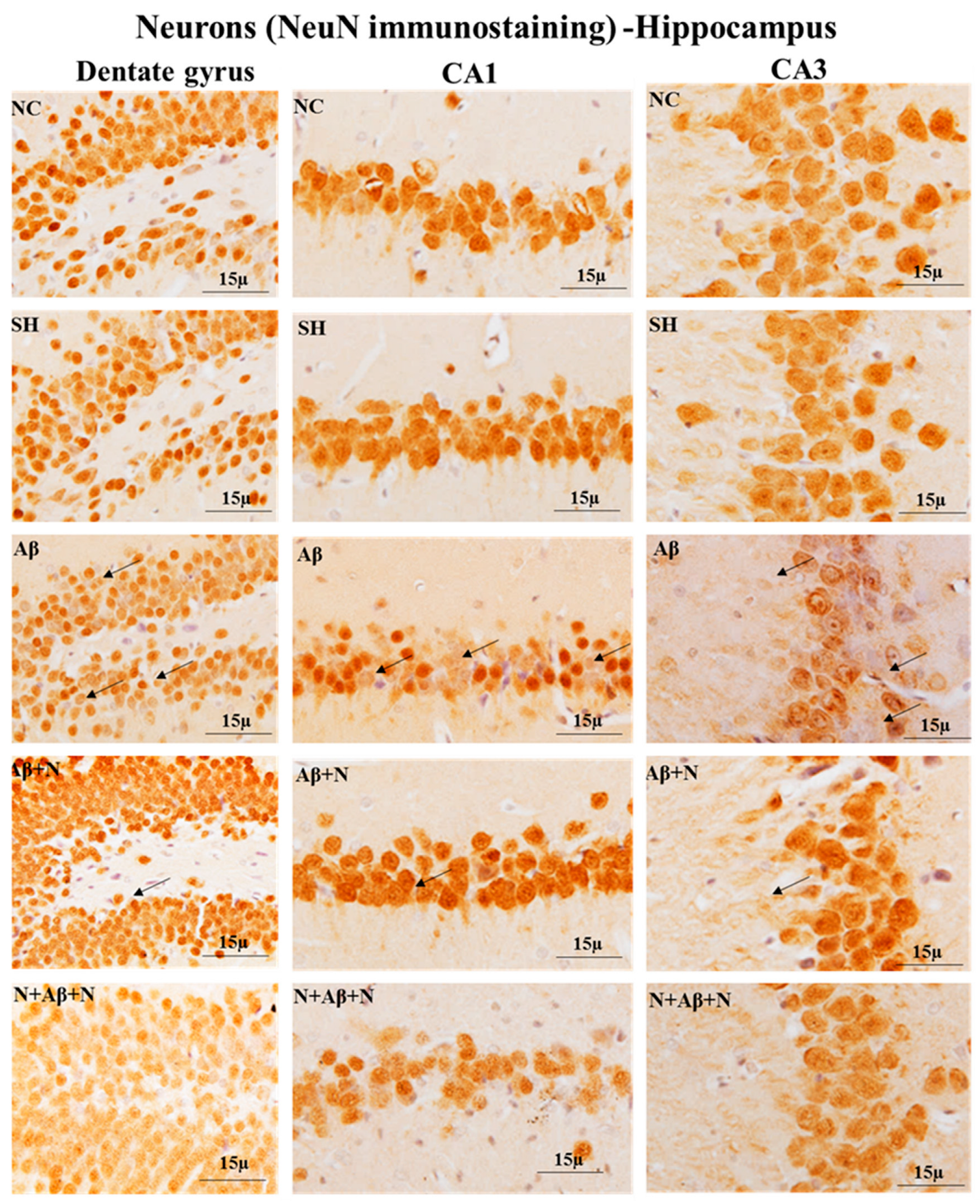 Ijms 24 12733 g013 Ijms 24 12733 g013