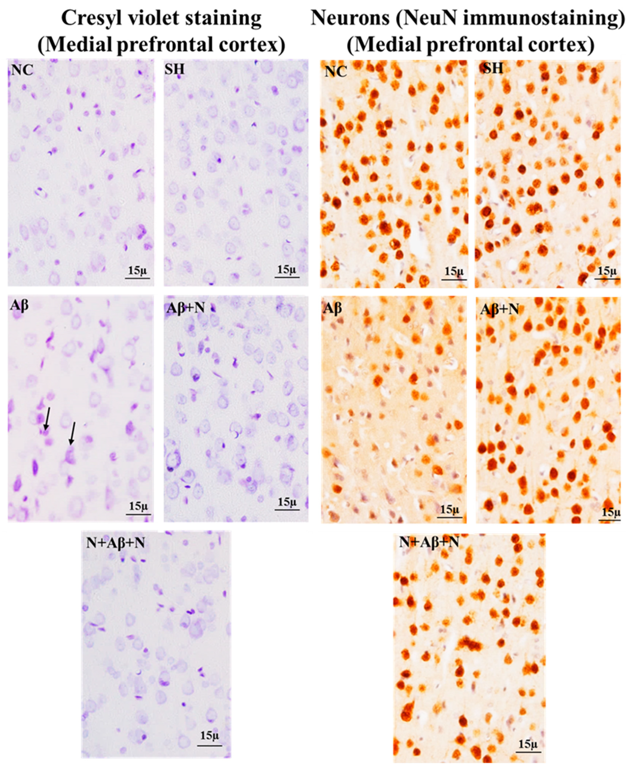 Ijms 24 12733 g014 Ijms 24 12733 g014