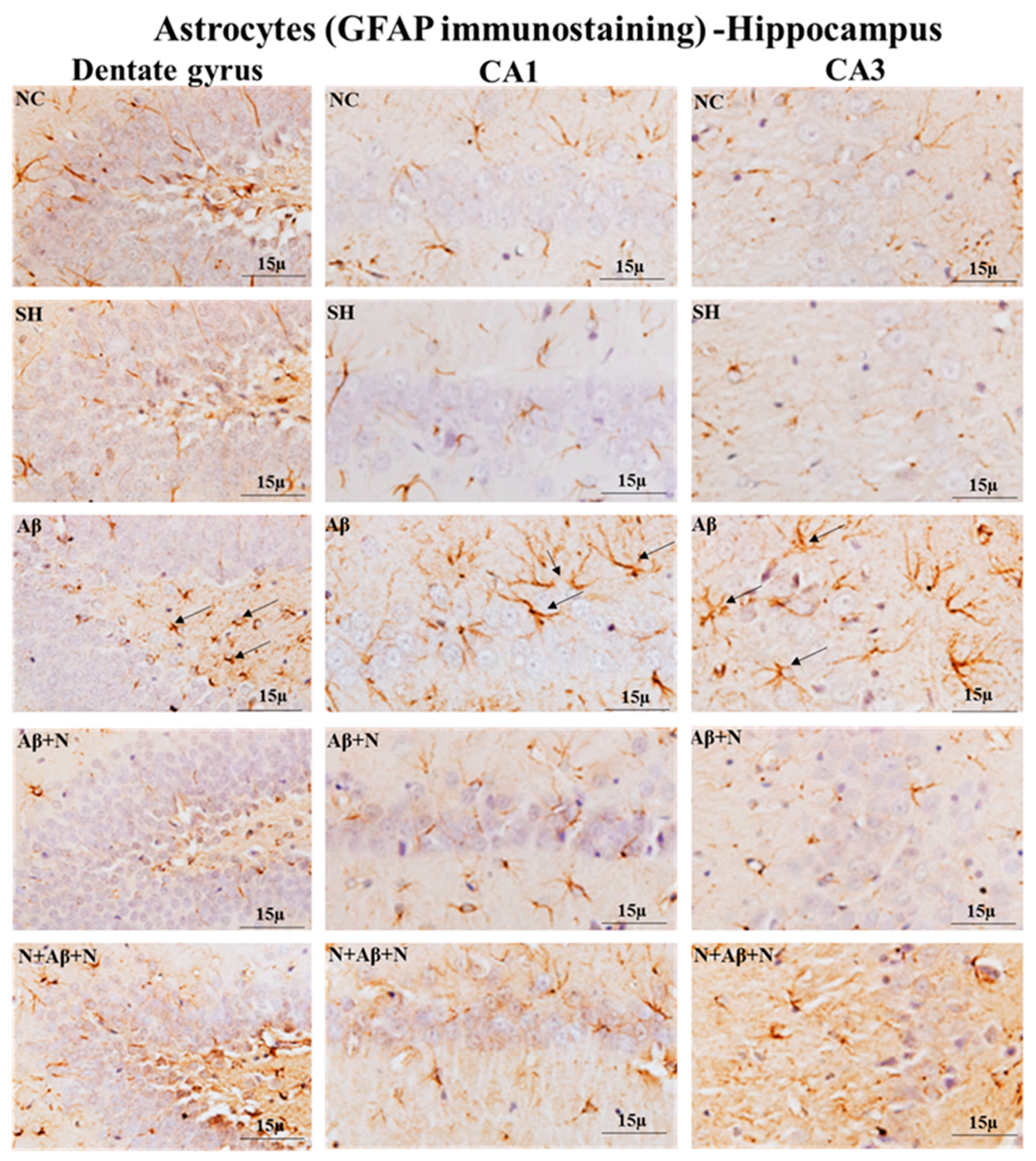 Ijms 24 12733 g015 Ijms 24 12733 g015