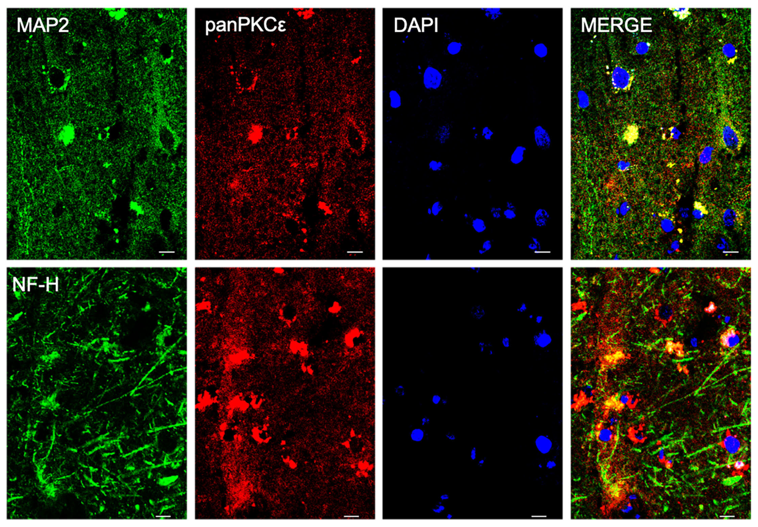 Ijms 24 12825 g001 Ijms 24 12825 g001