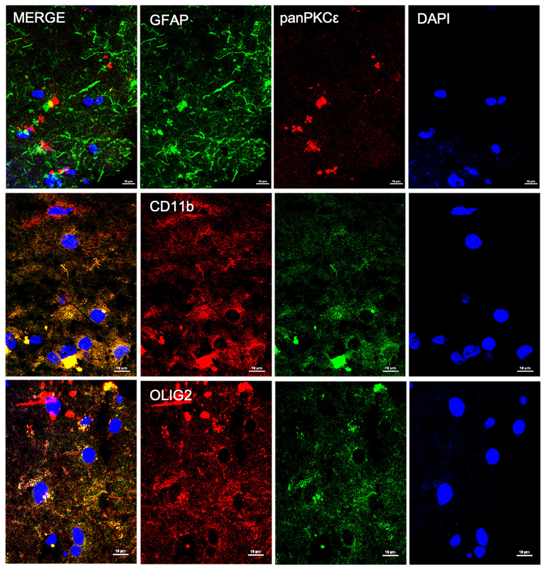 Ijms 24 12825 g002 Ijms 24 12825 g002