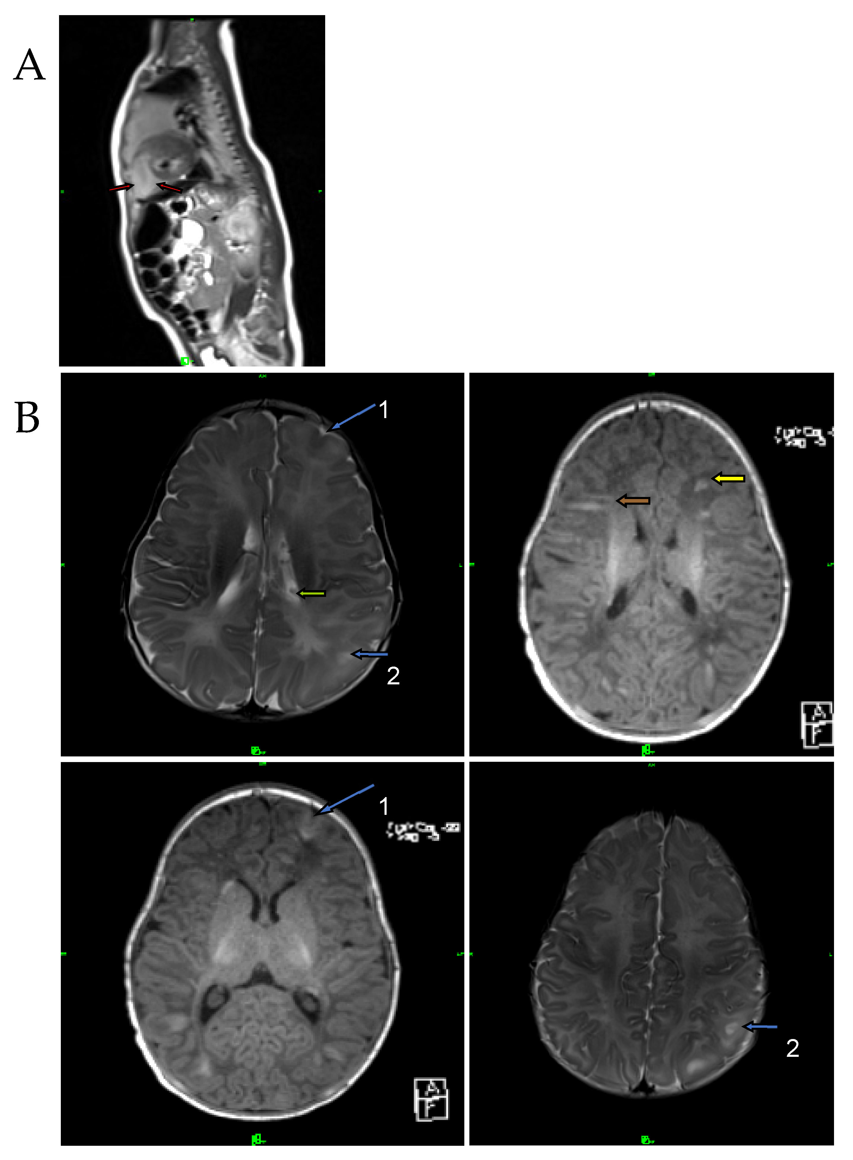 Ijms 24 12886 g004 Ijms 24 12886 g004