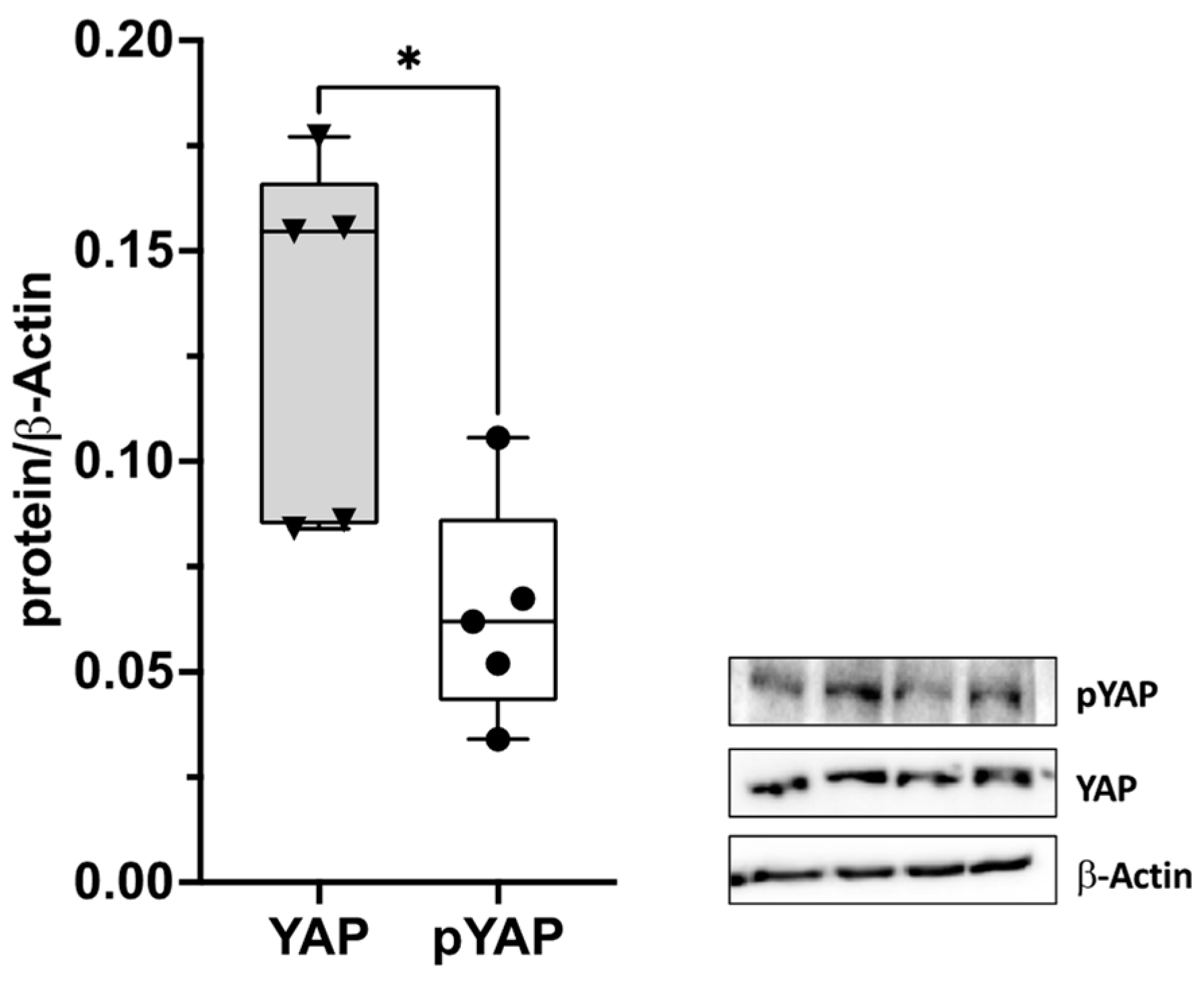 A New Player in the Mechanobiology of Deep Fascia: Yes-Associated ...