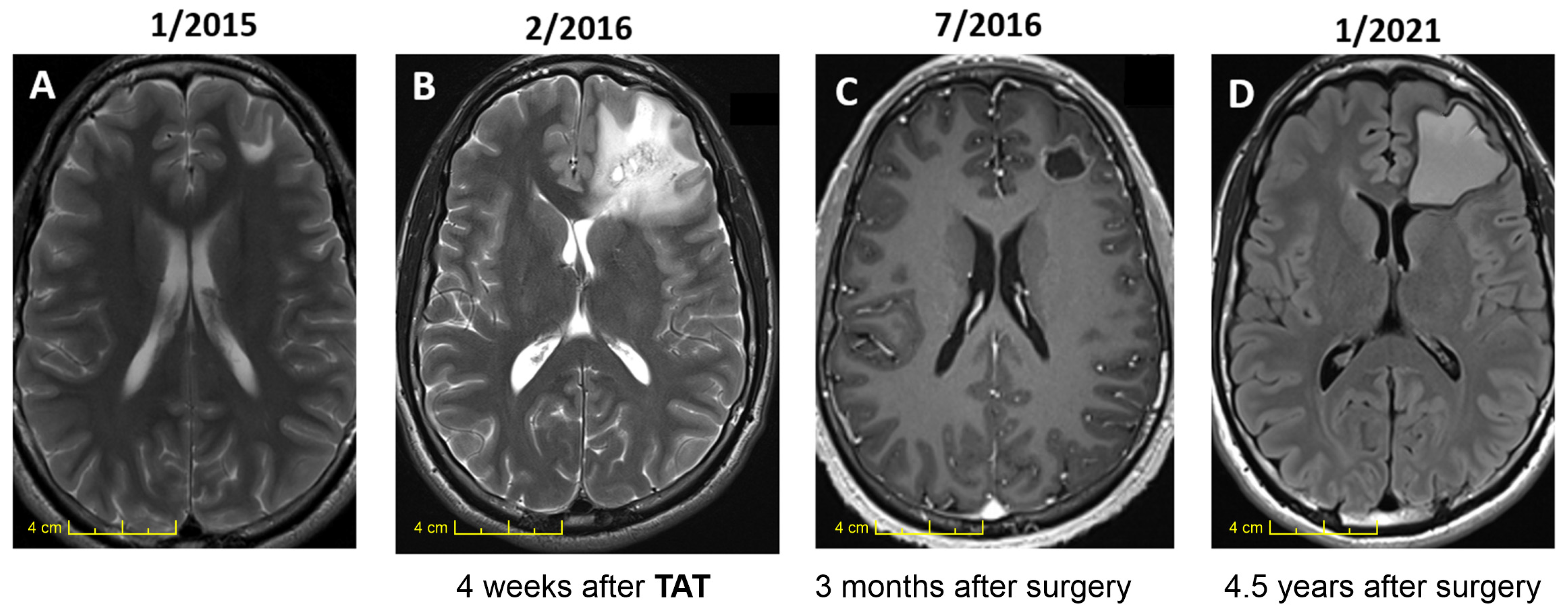 Ijms 24 15701 g003 Ijms 24 15701 g003