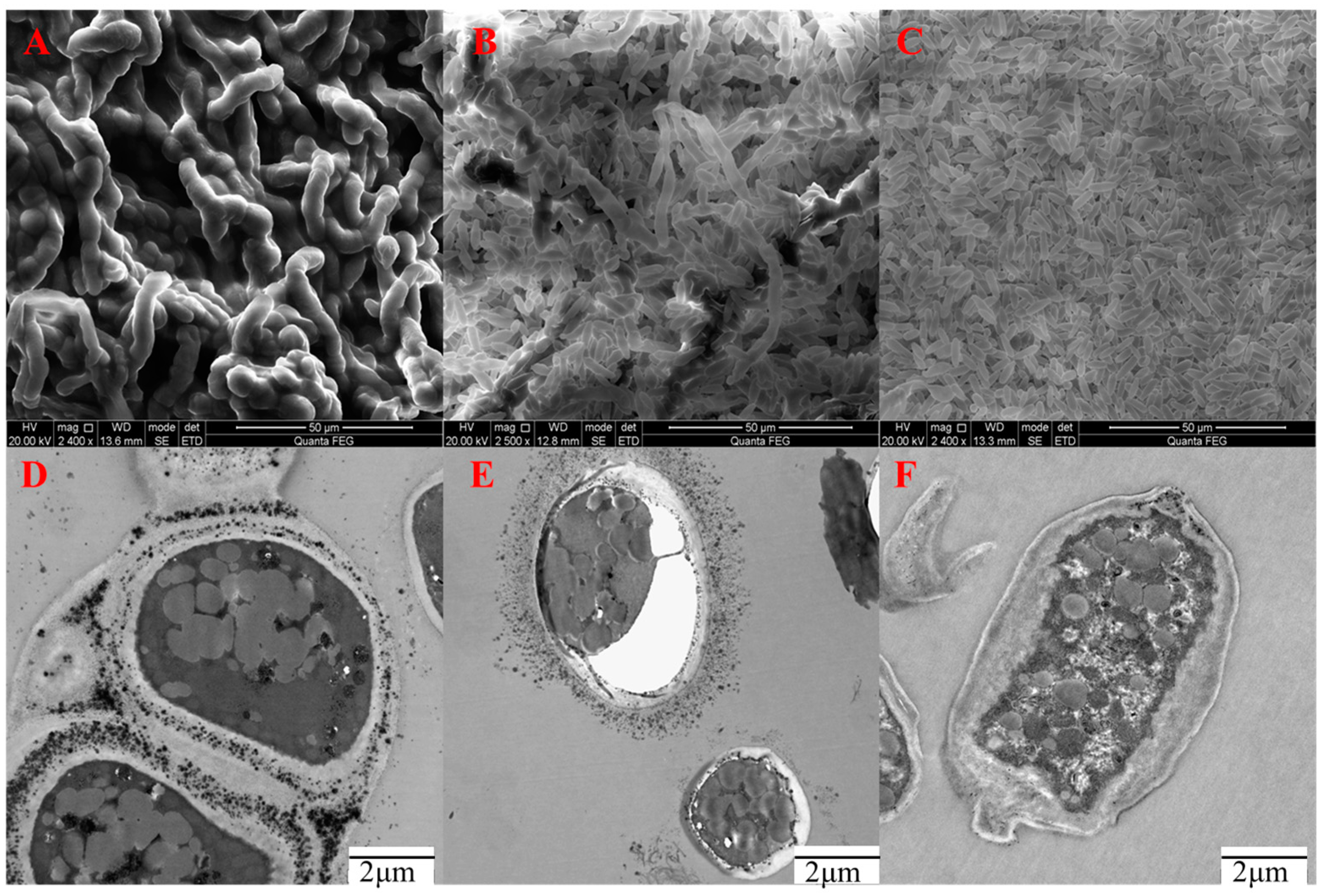 Ijms 24 16103 g004 Ijms 24 16103 g004