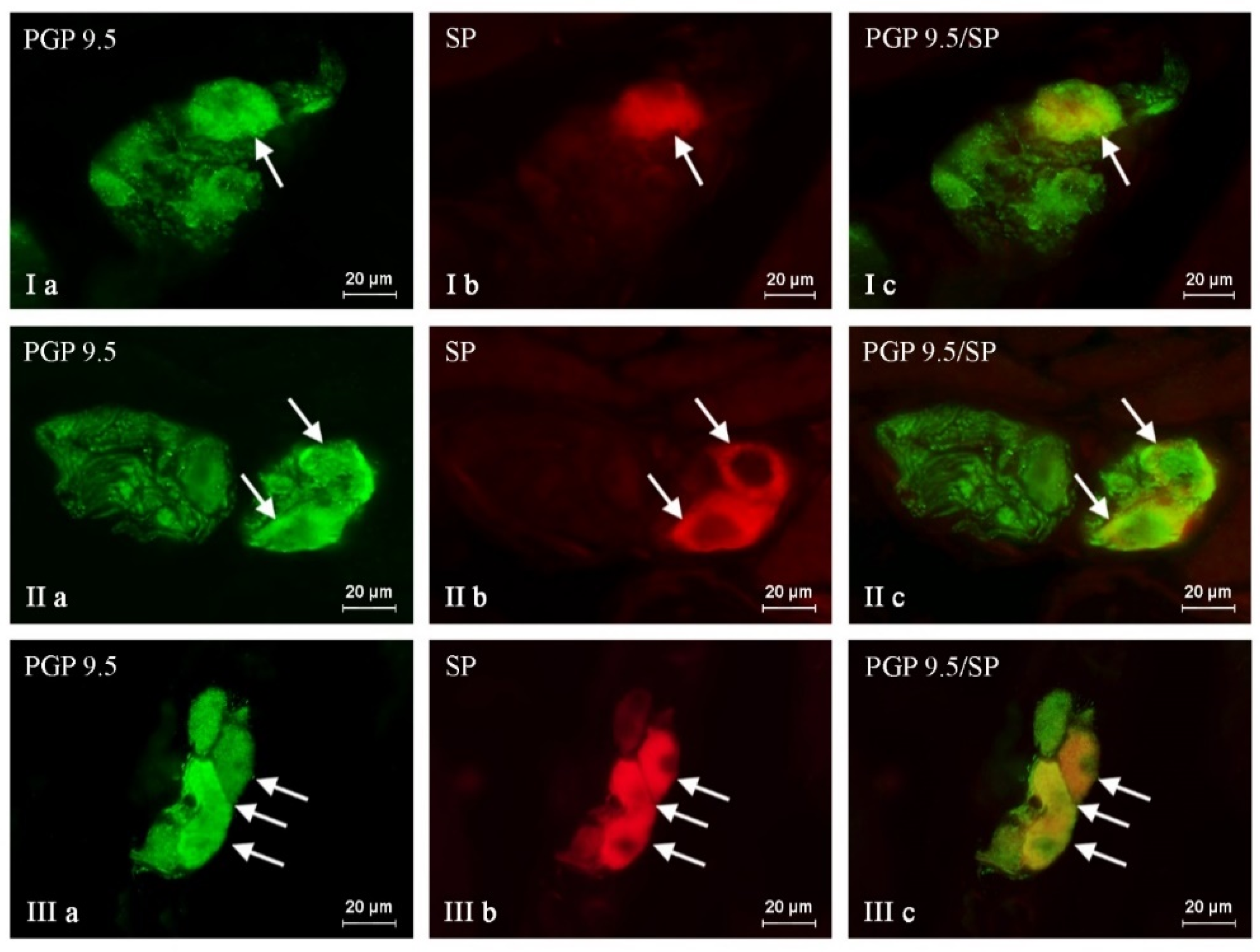 Ijms 24 16792 g004 Ijms 24 16792 g004