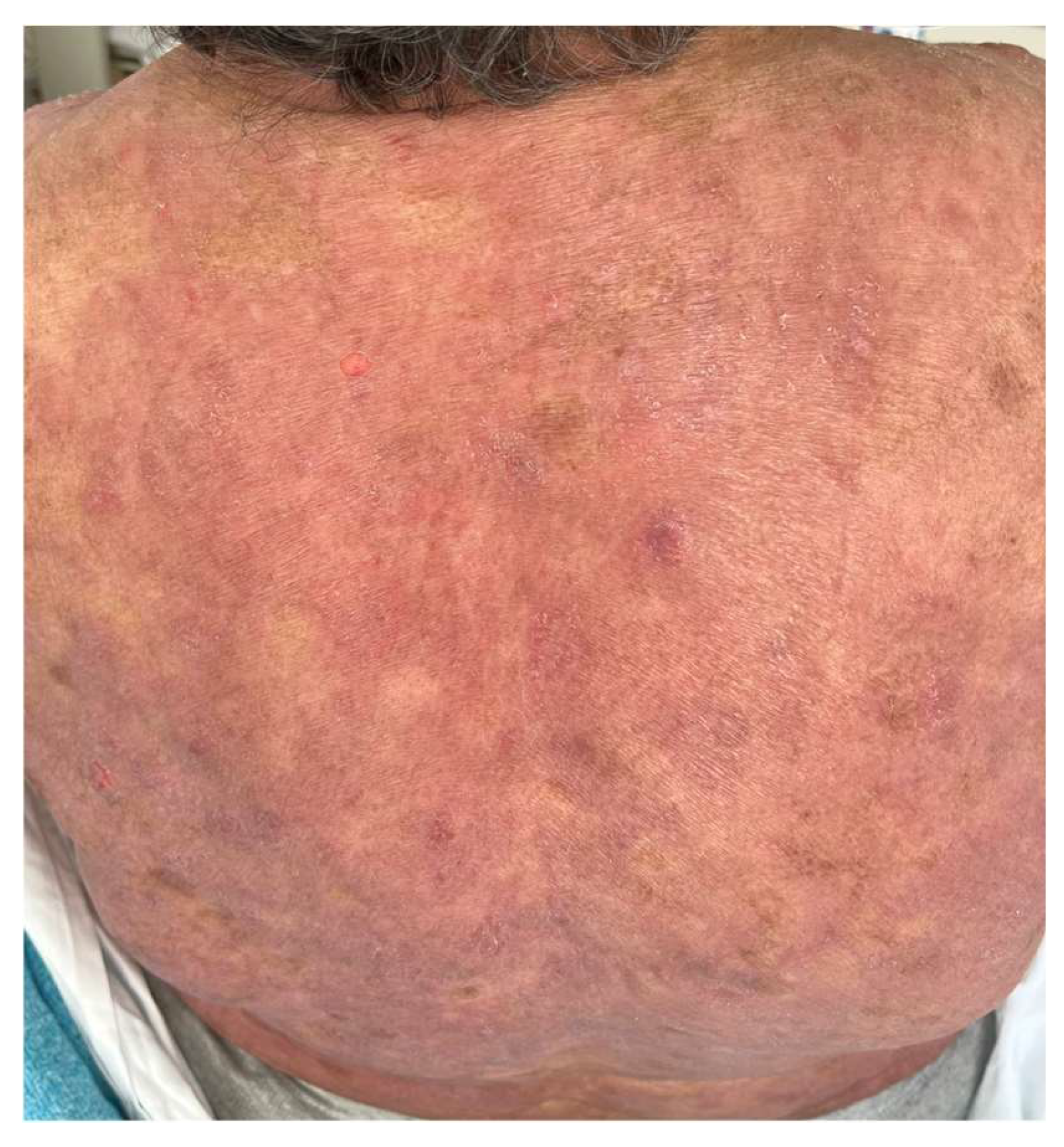 Ijms 25 02203 g004 Ijms 25 02203 g004