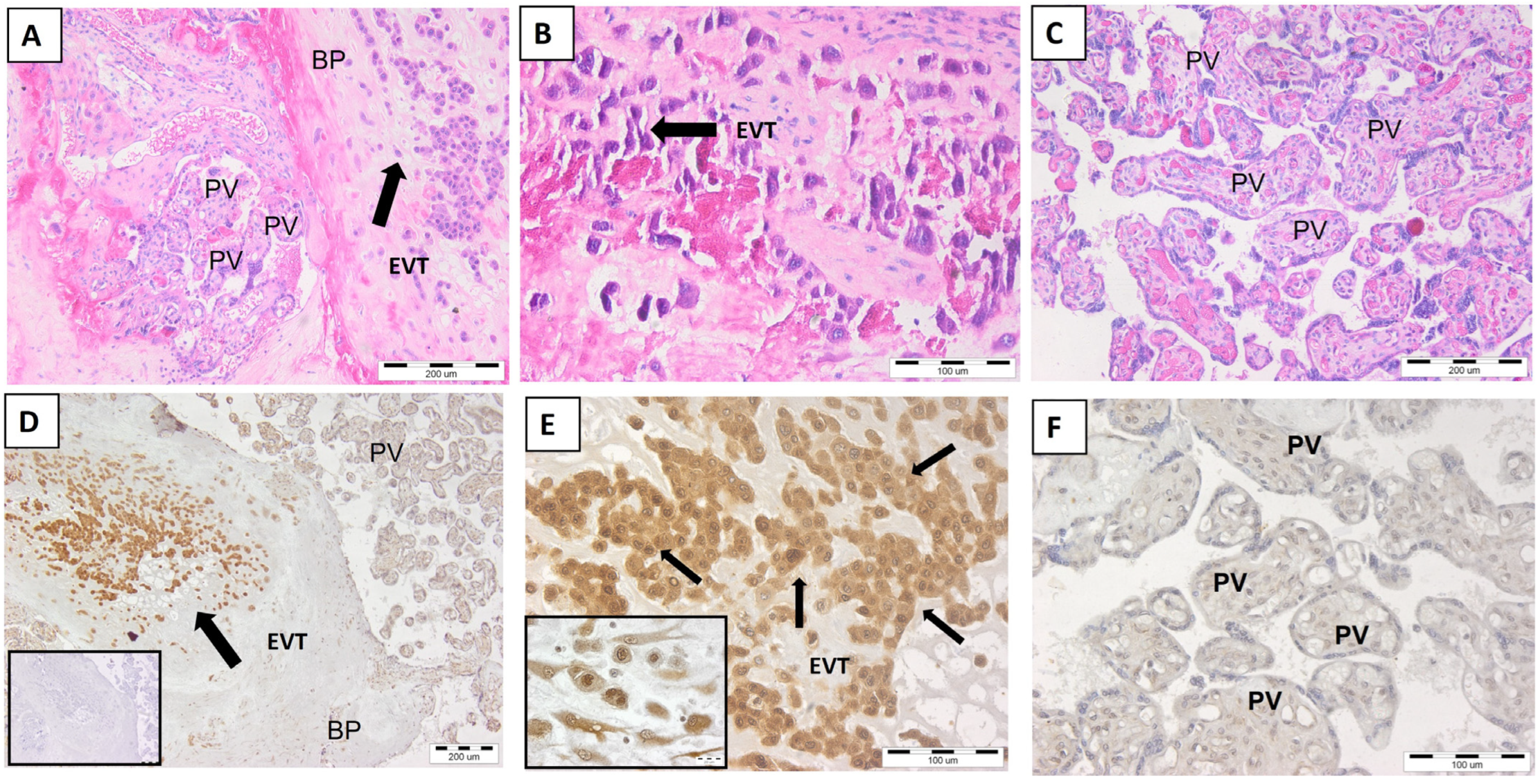 Ijms 25 02643 g003 Ijms 25 02643 g003