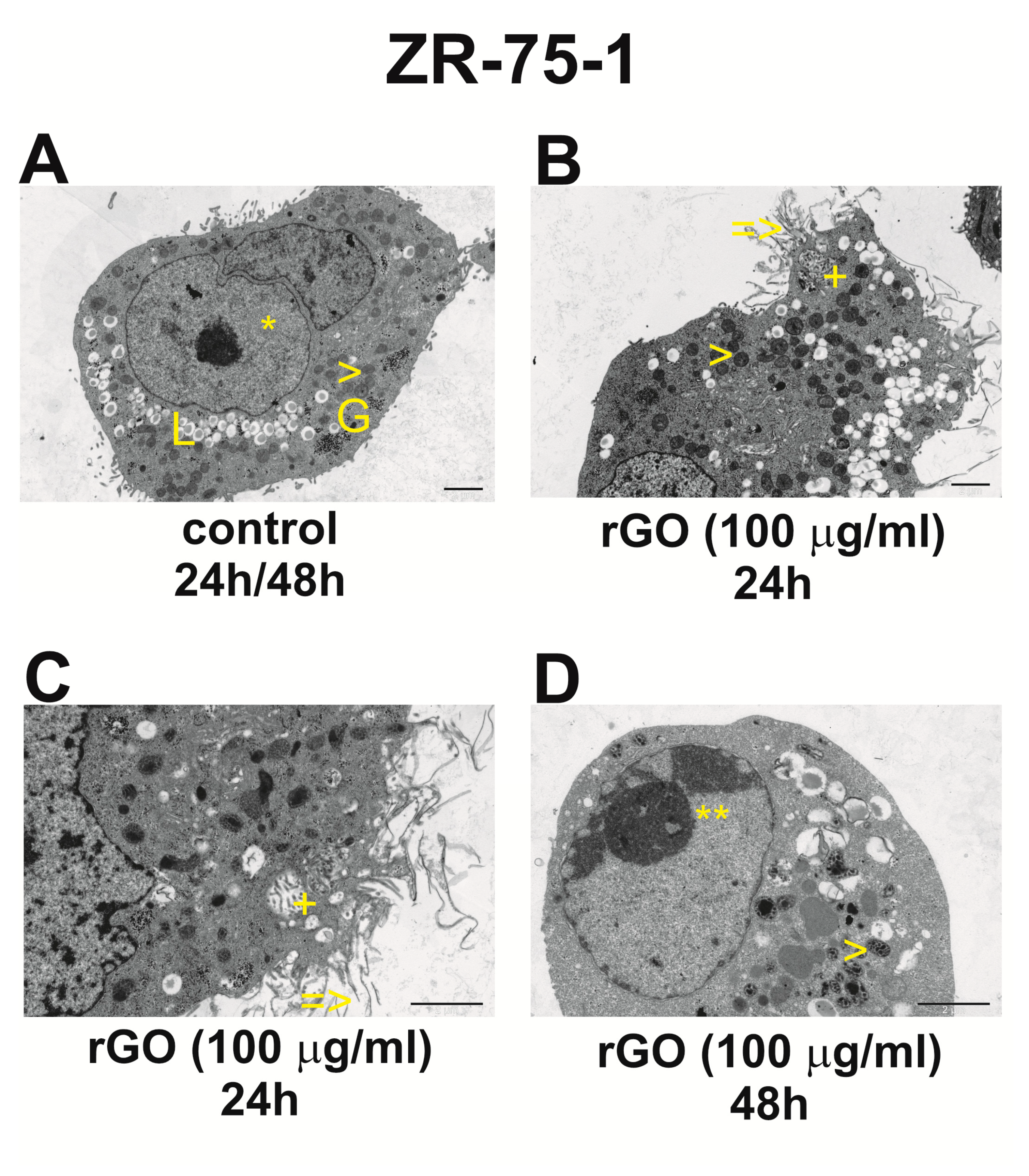 Ijms 25 05436 g007