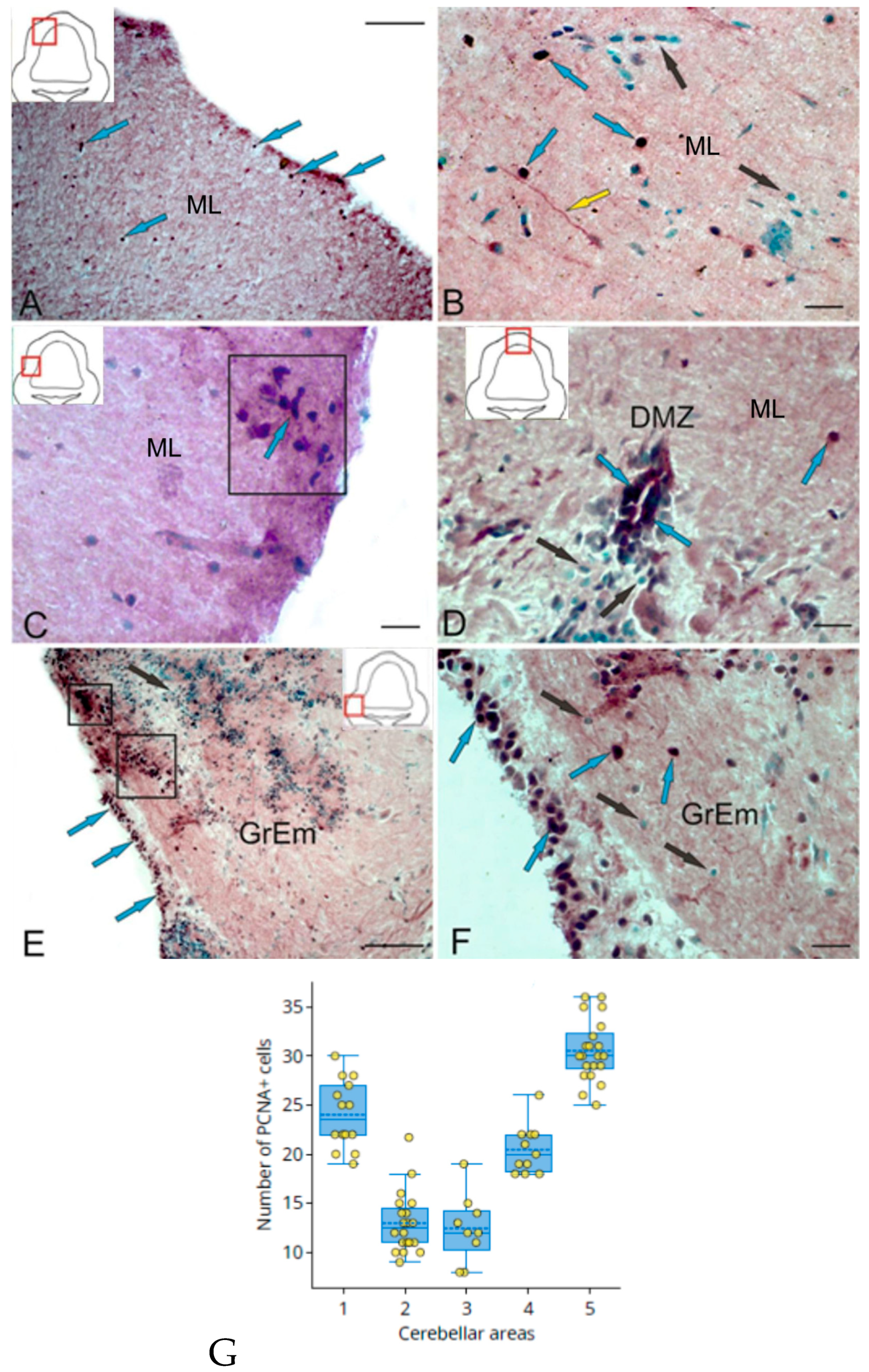Ijms 25 05595 g001 Ijms 25 05595 g001
