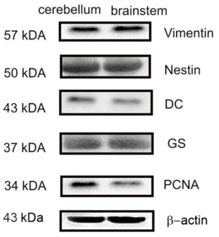 Ijms 25 05595 g013 Ijms 25 05595 g013