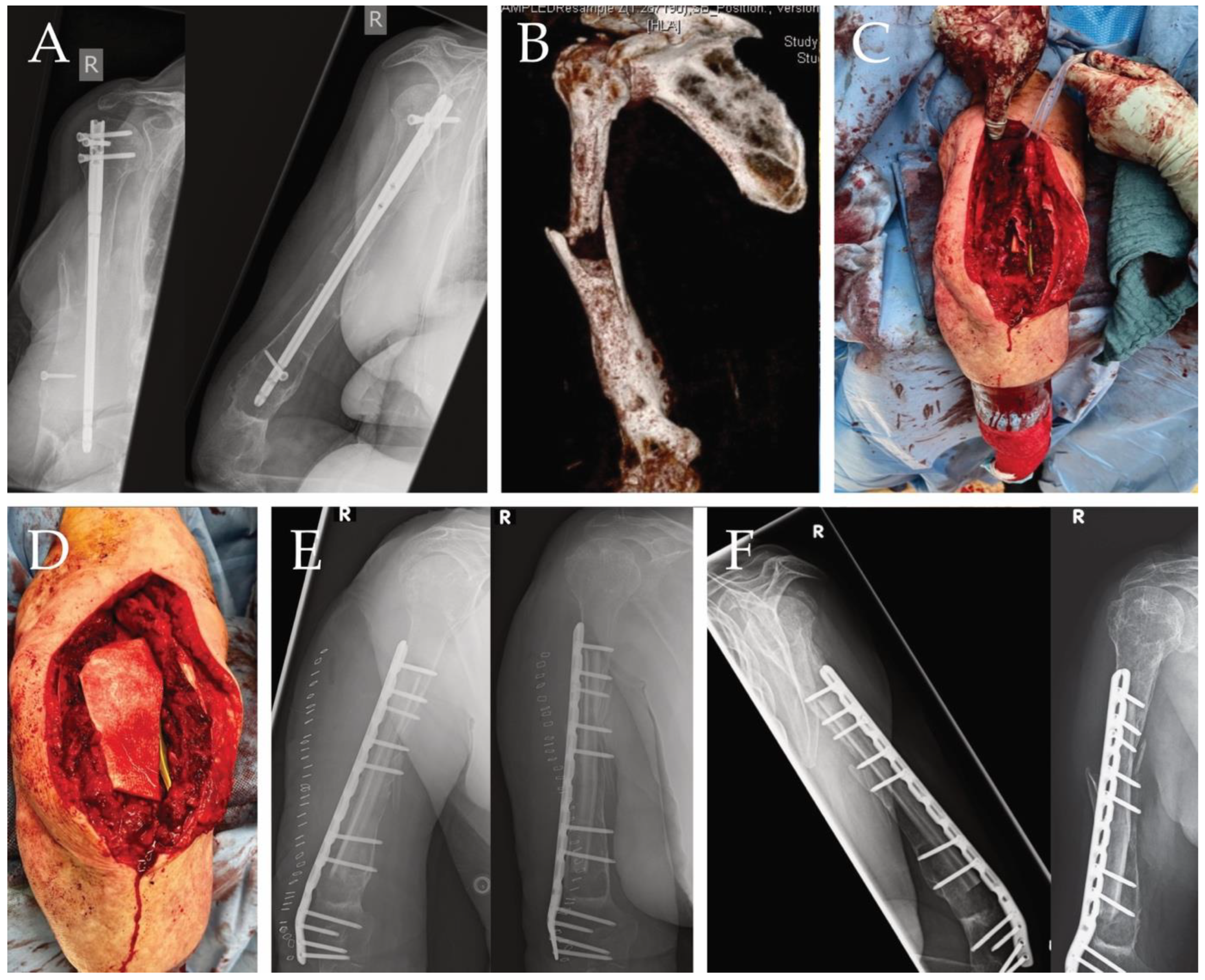 Ijms 25 07088 g002 Ijms 25 07088 g002