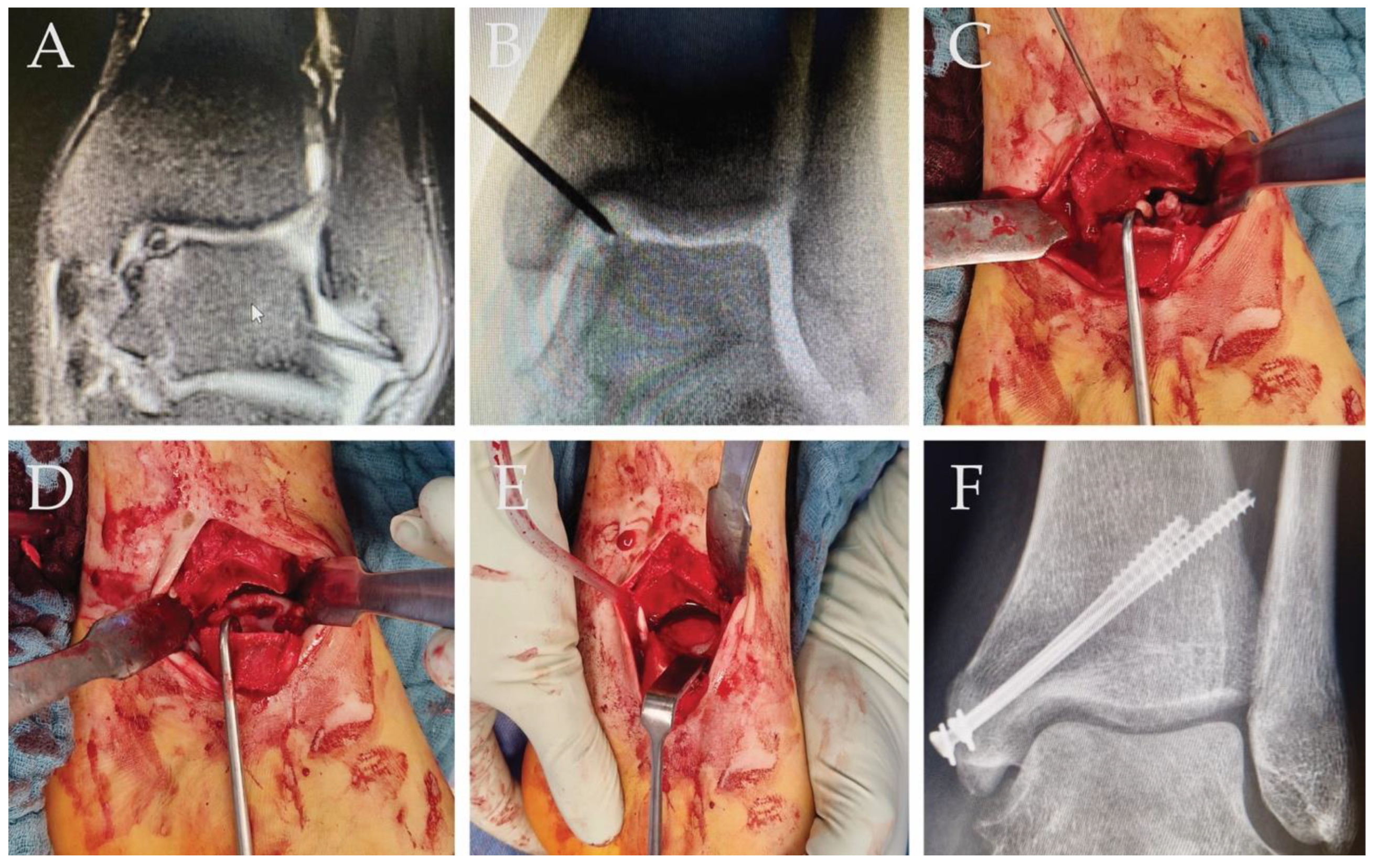 Ijms 25 07088 g003 Ijms 25 07088 g003