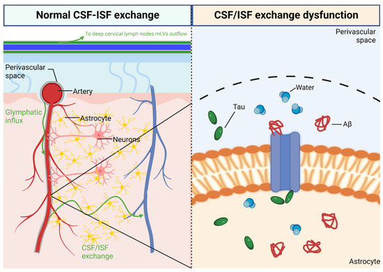 Pathogenesis of Cerebral Small Vessel Disease: Role of the Glymphatic ...