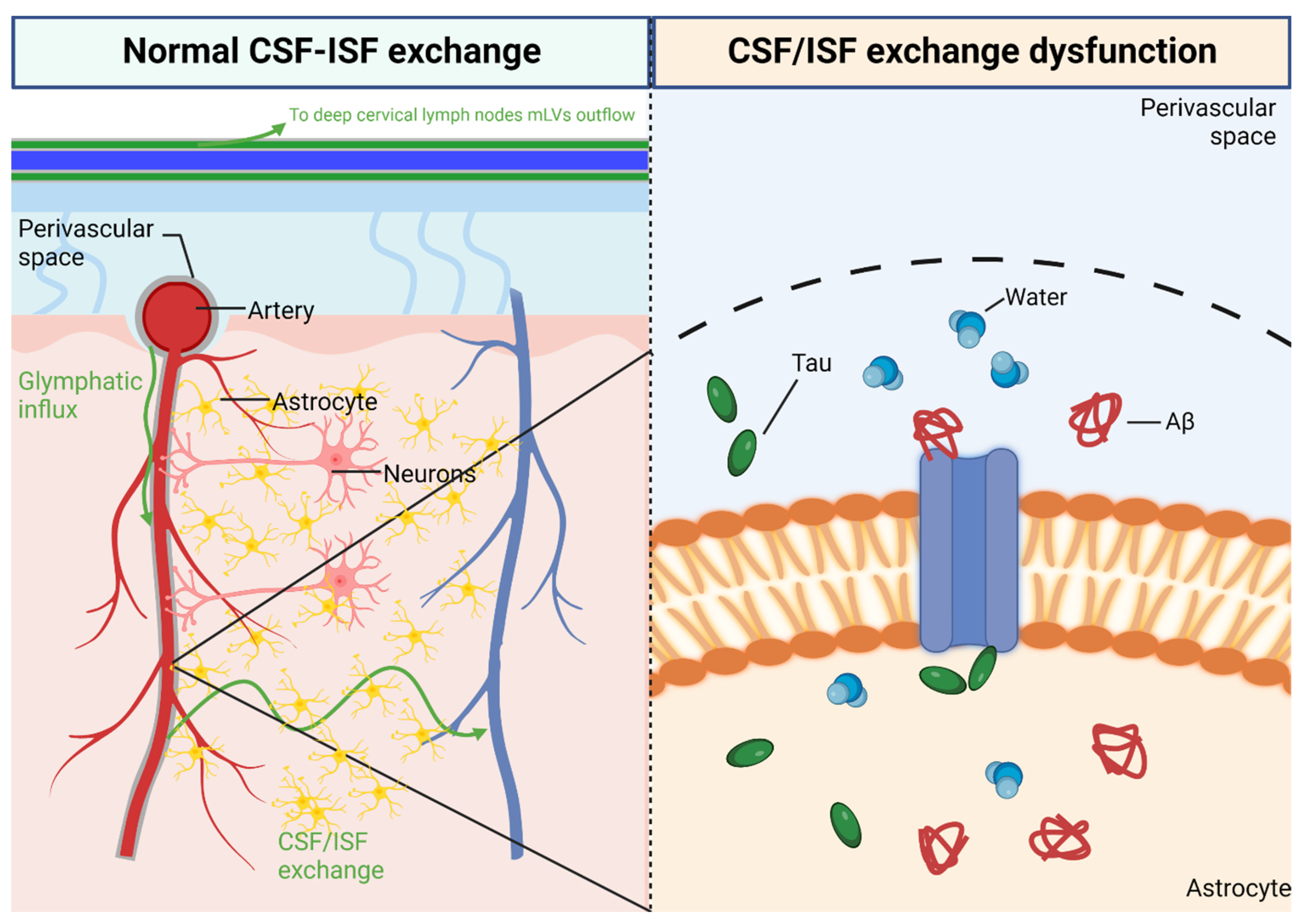 Pathogenesis of Cerebral Small Vessel Disease: Role of the Glymphatic ...