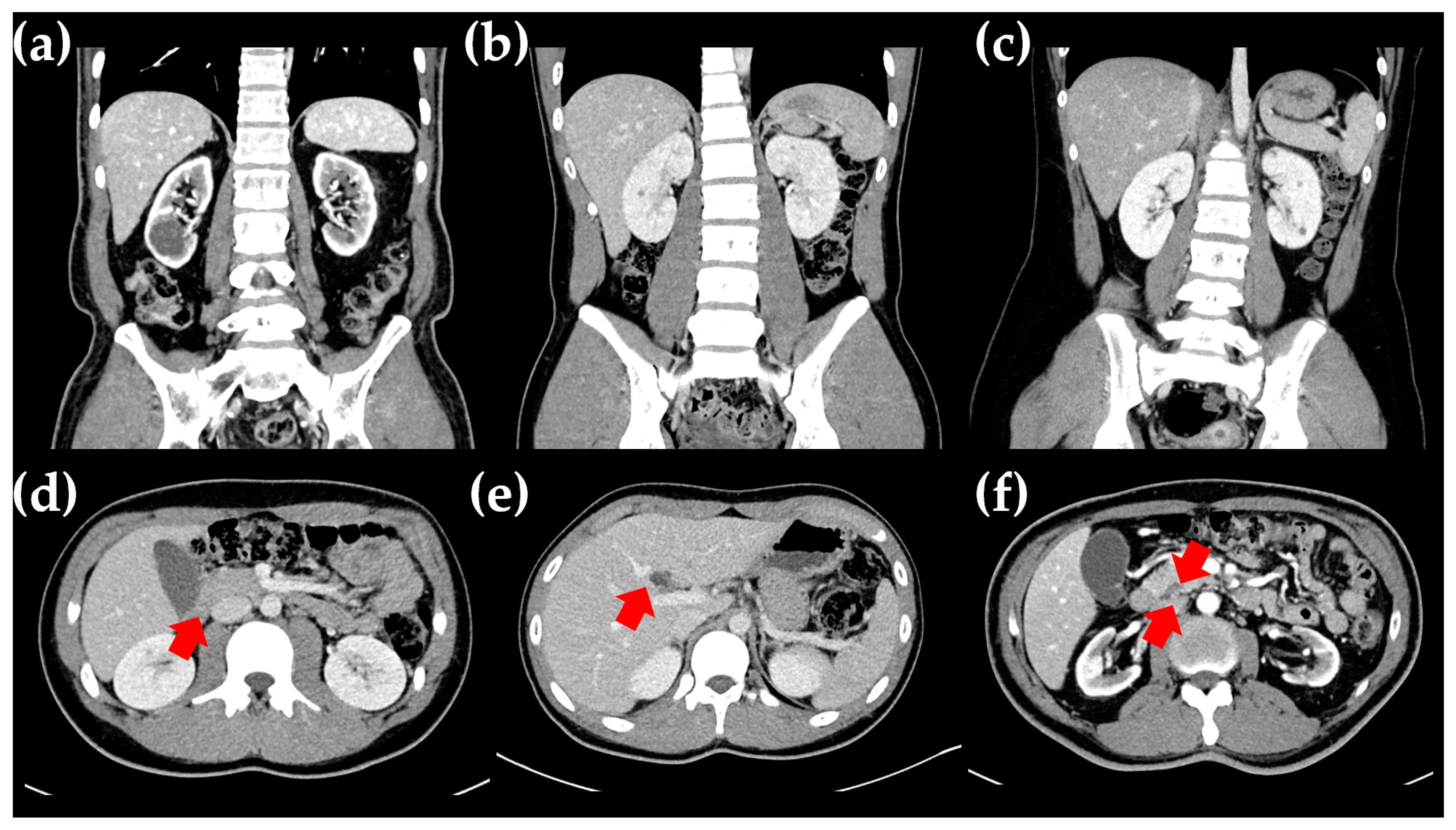 Ijms 25 09823 g002 Ijms 25 09823 g002
