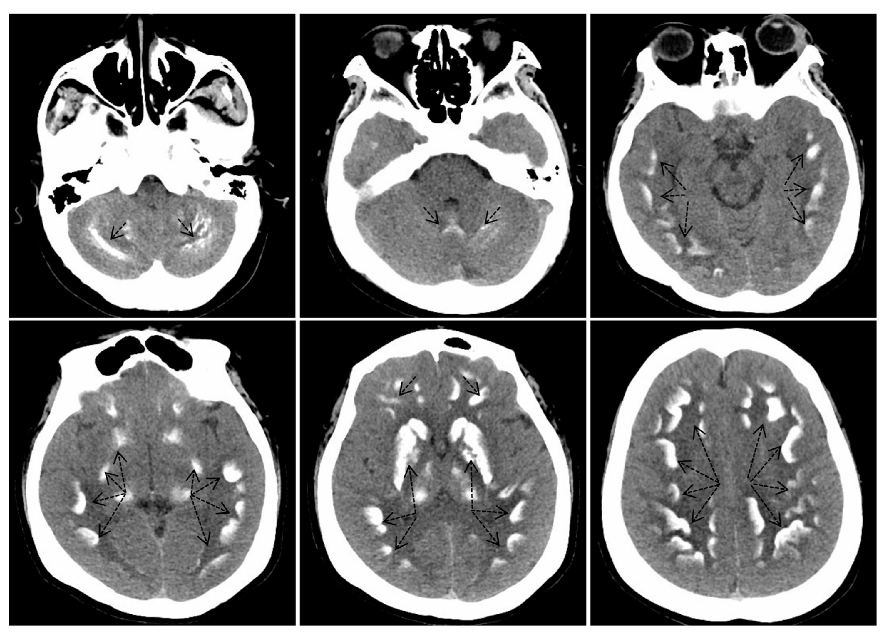 Ijms 25 11611 g002 Ijms 25 11611 g002