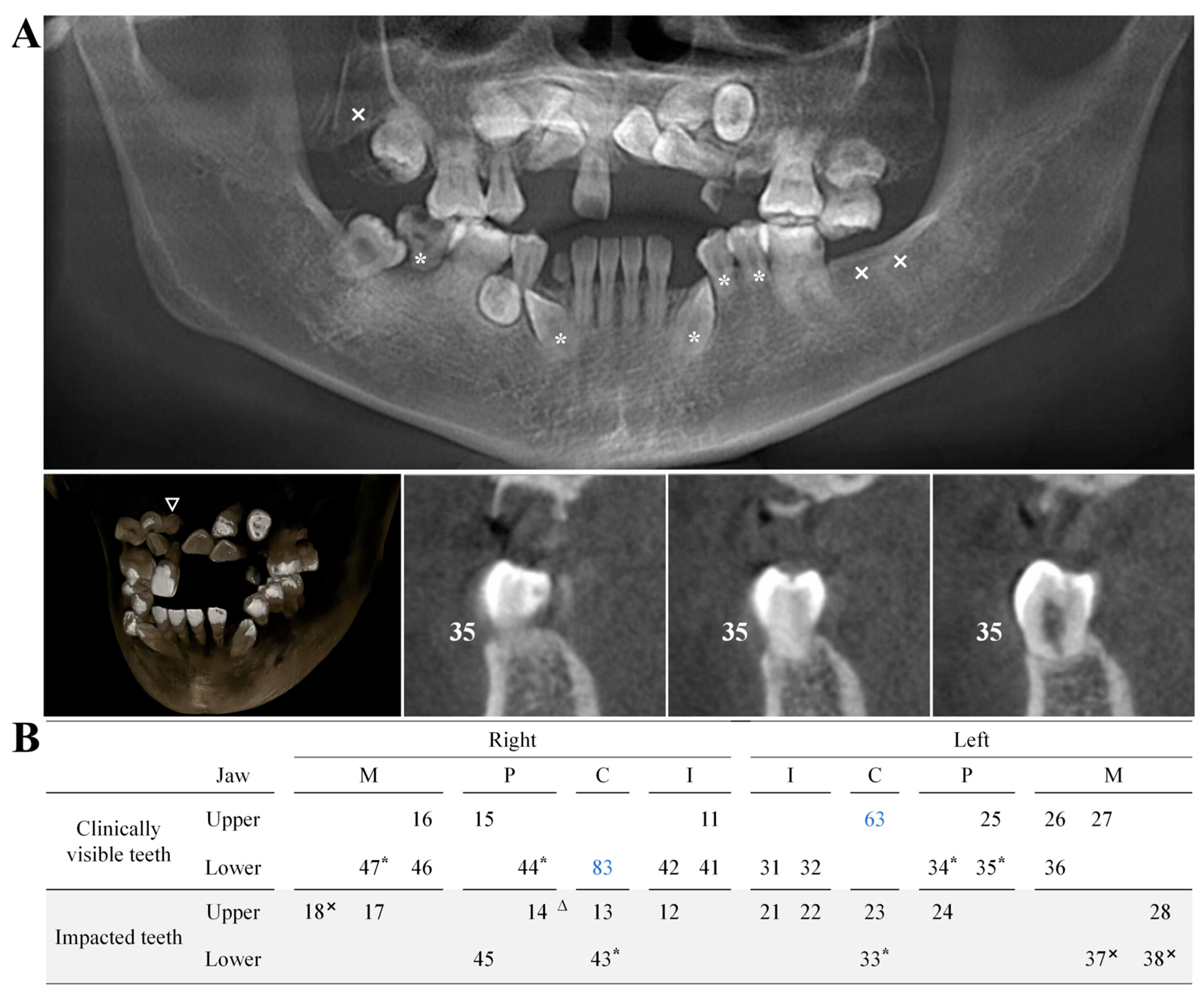 Ijms 25 11611 g003 Ijms 25 11611 g003