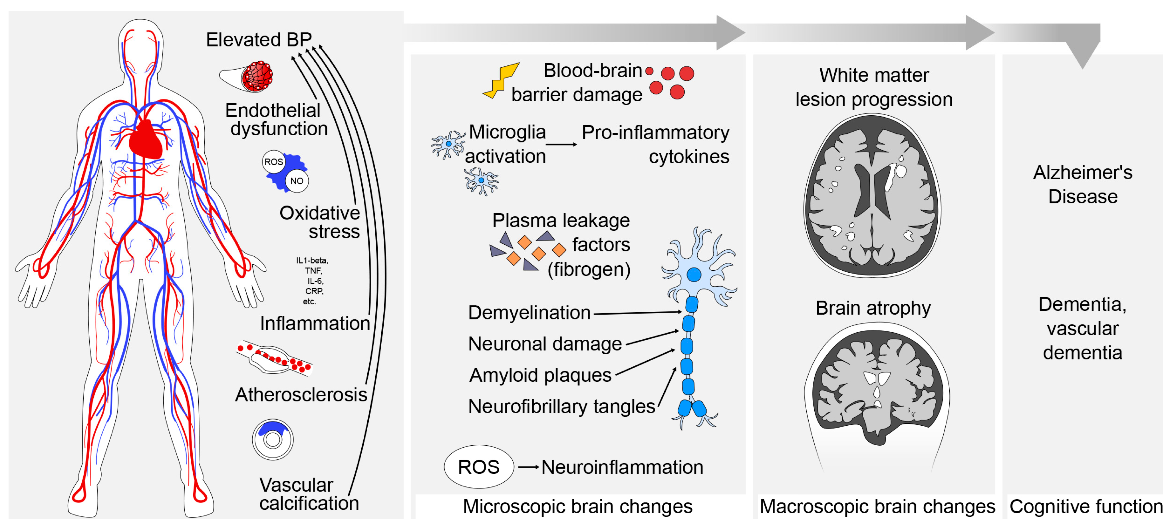 High Blood Pressure and Impaired Brain Health: Investigating the ...