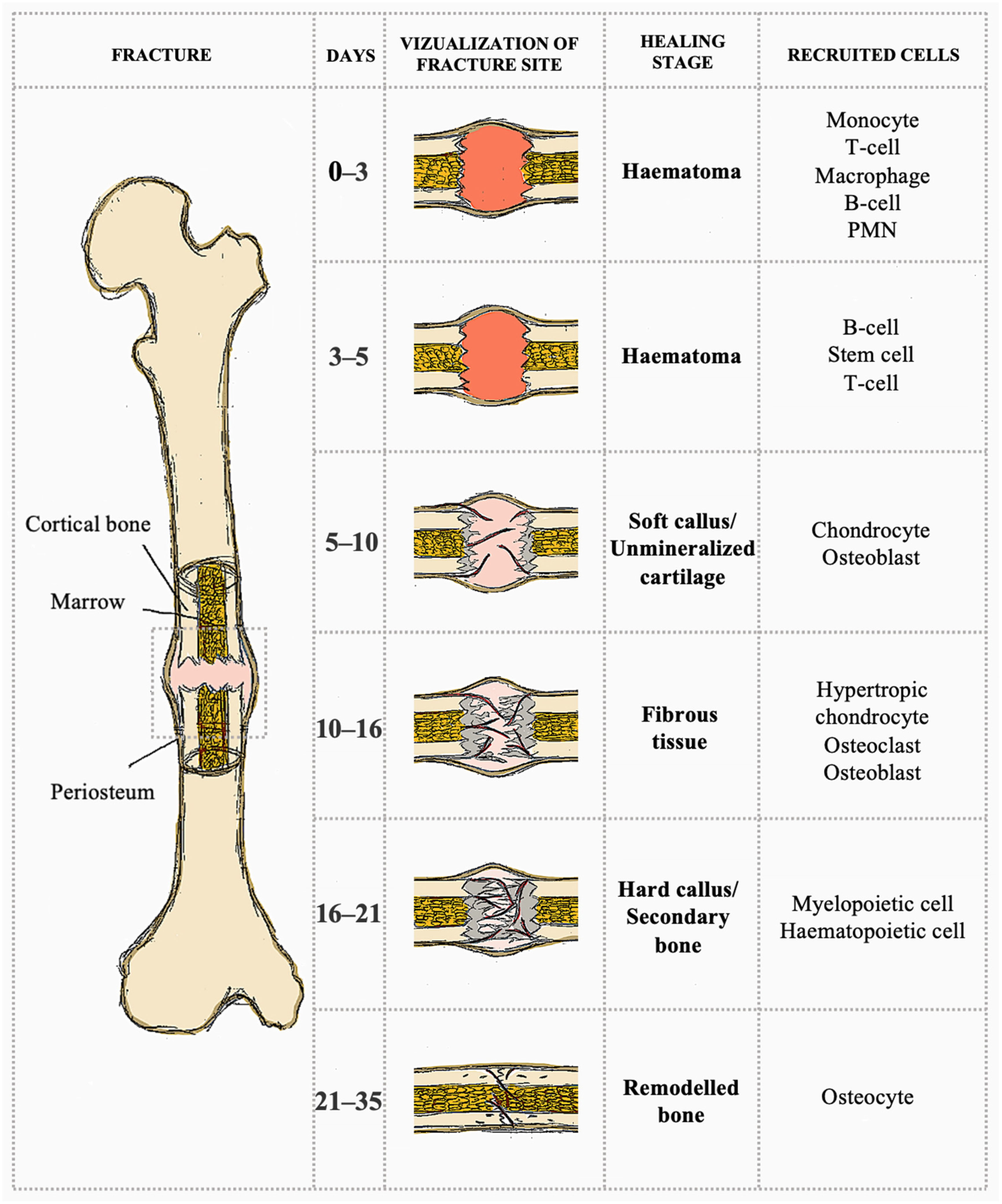 The Future of Bone Repair: Emerging Technologies and Biomaterials in ...