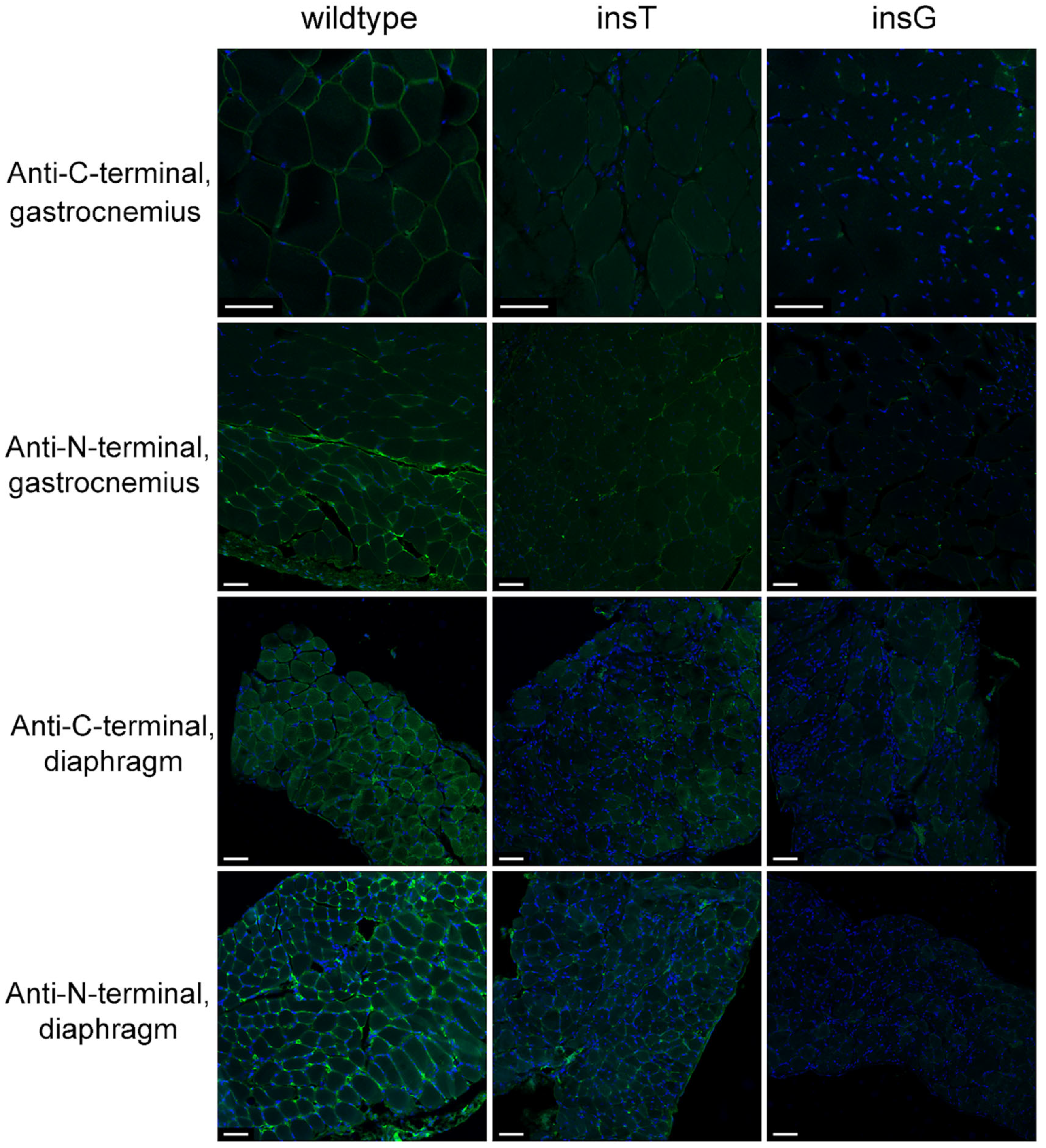 Two Novel Mouse Models of Duchenne Muscular Dystrophy with Similar Dmd ...