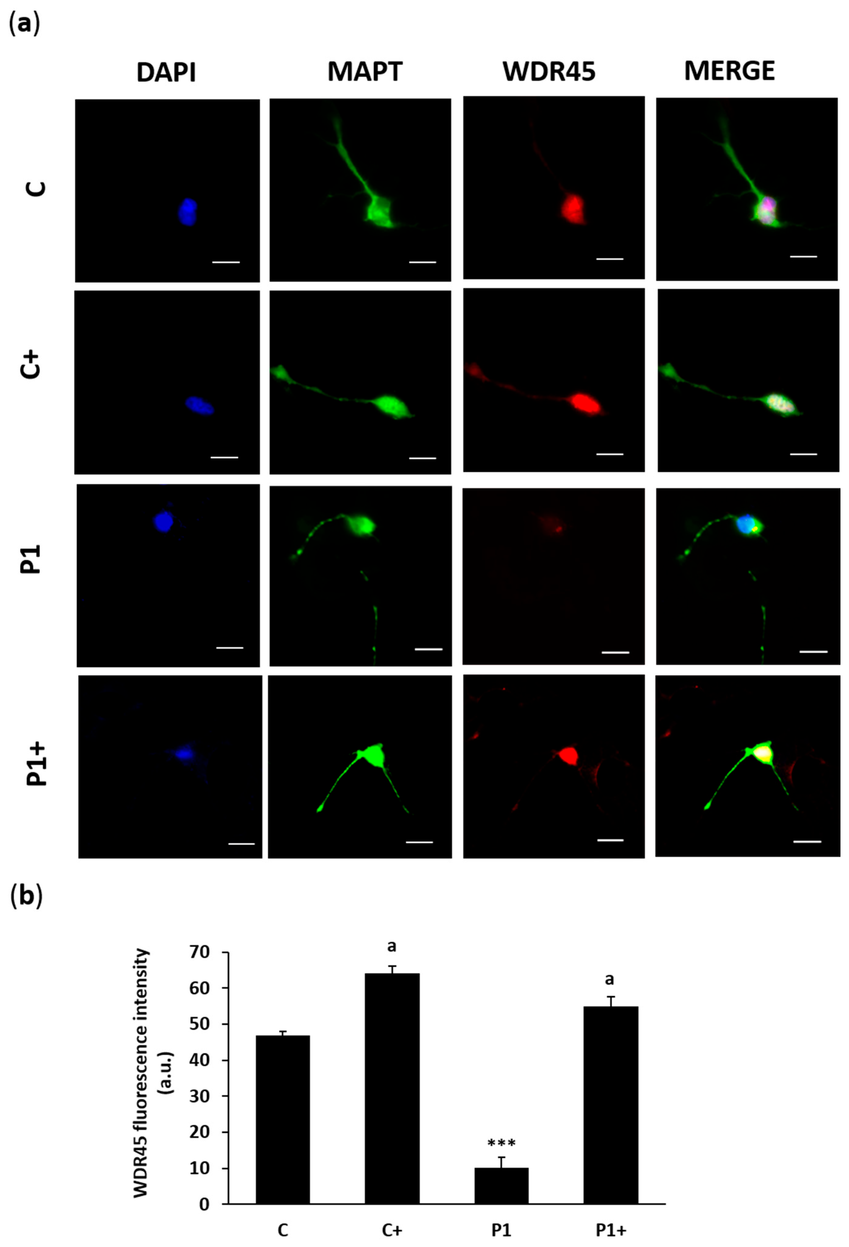 Ijms 26 01315 g018 Ijms 26 01315 g018