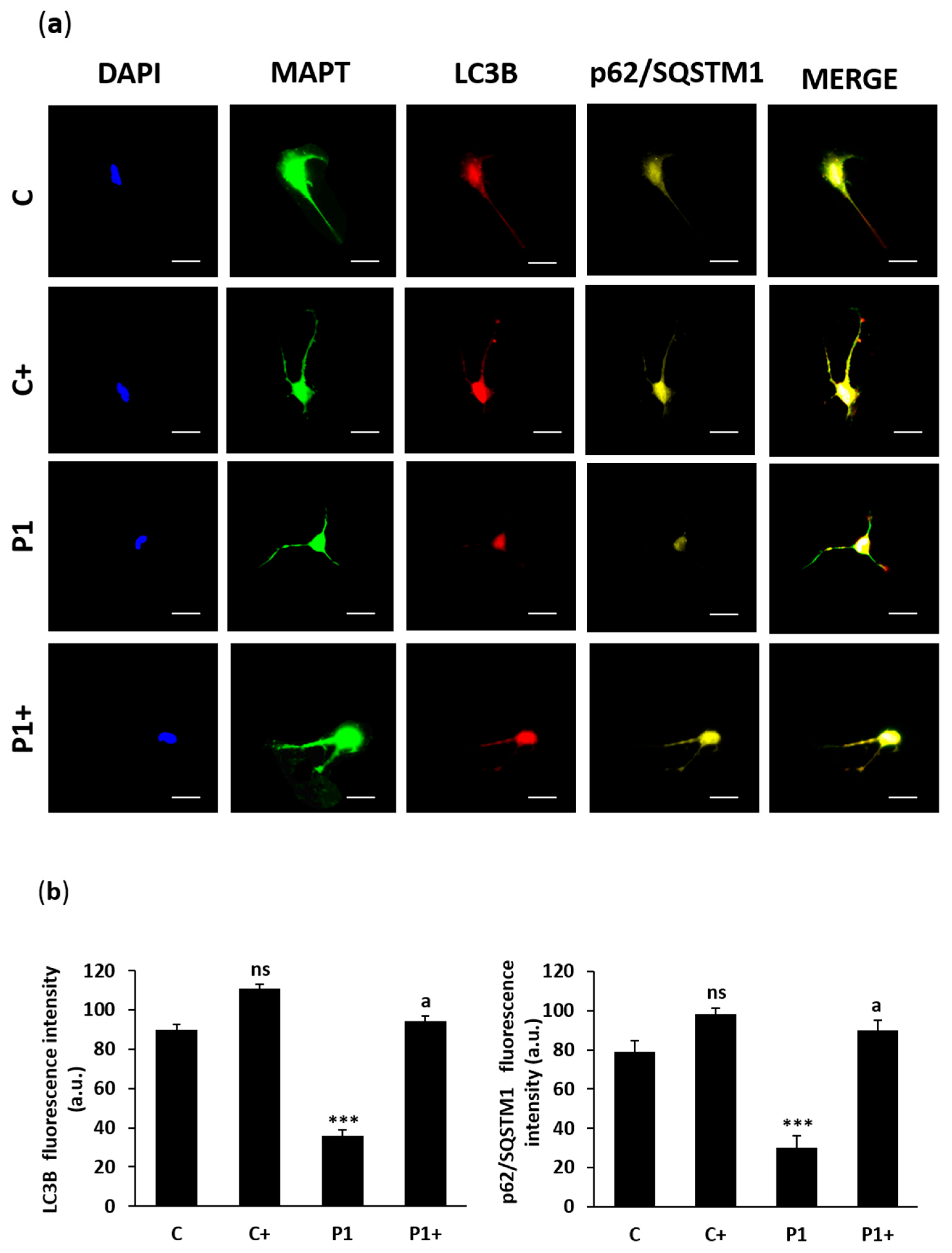 Ijms 26 01315 g019 Ijms 26 01315 g019