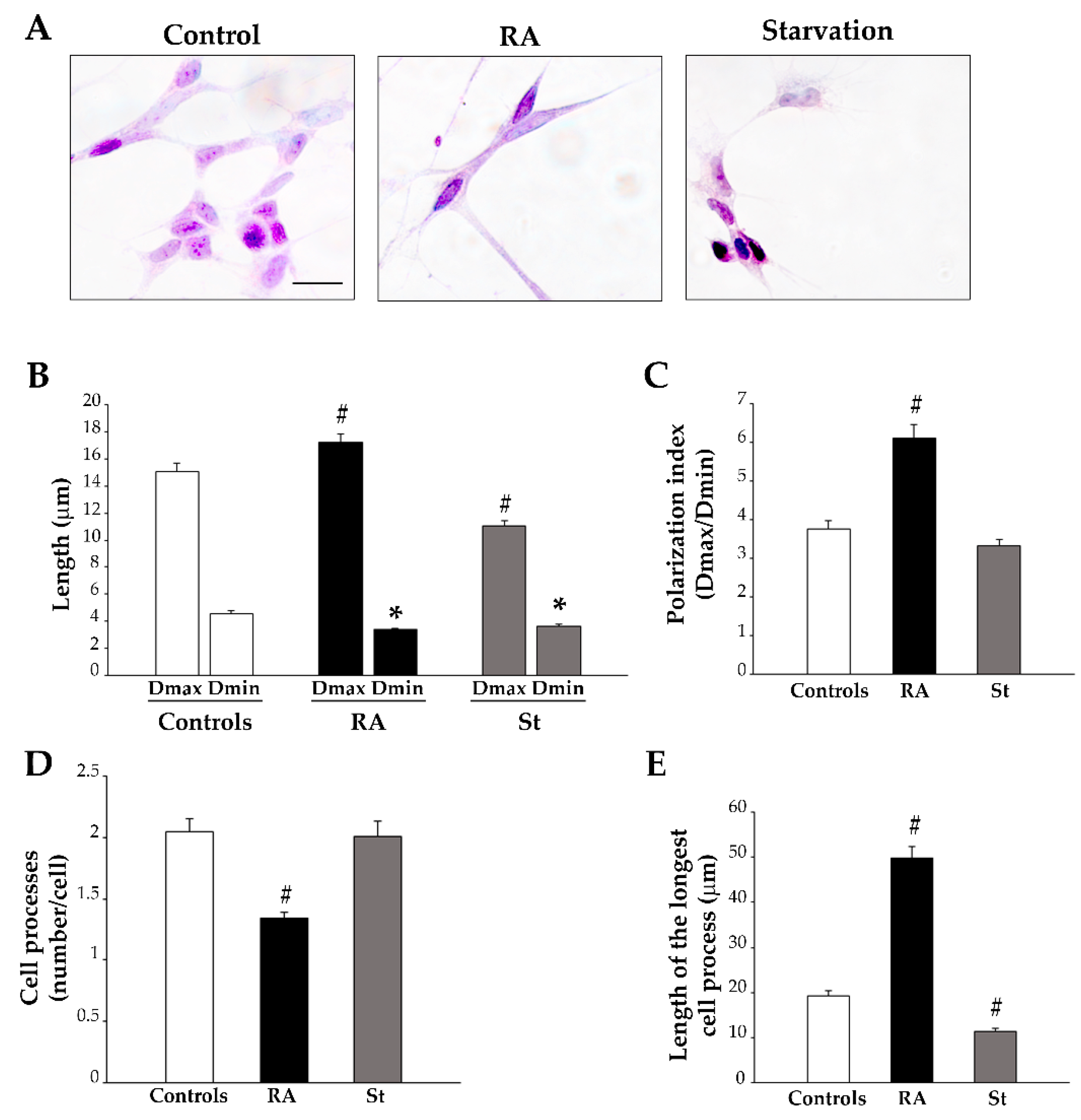 Ijms 26 01691 g004 Ijms 26 01691 g004