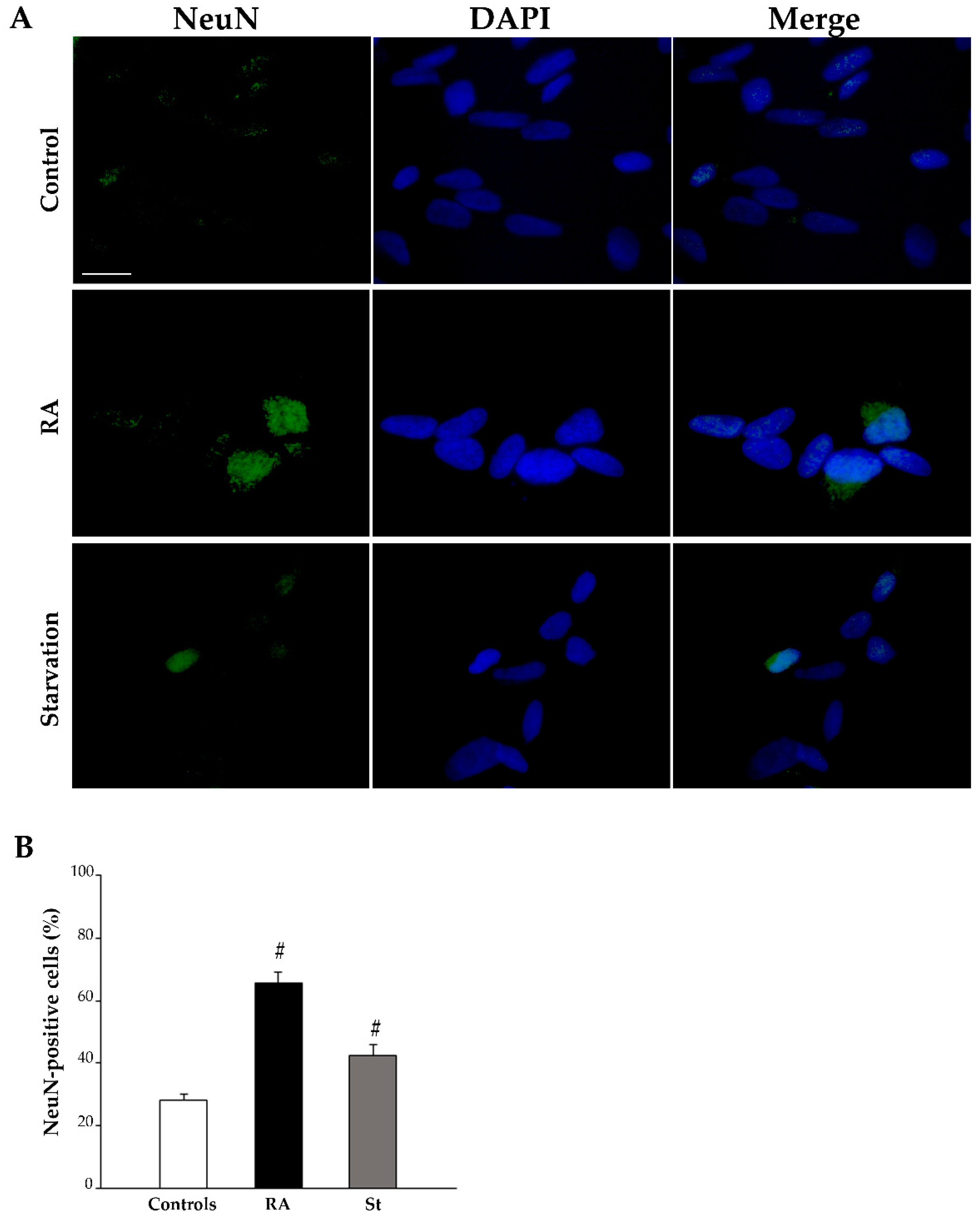 Ijms 26 01691 g007 Ijms 26 01691 g007