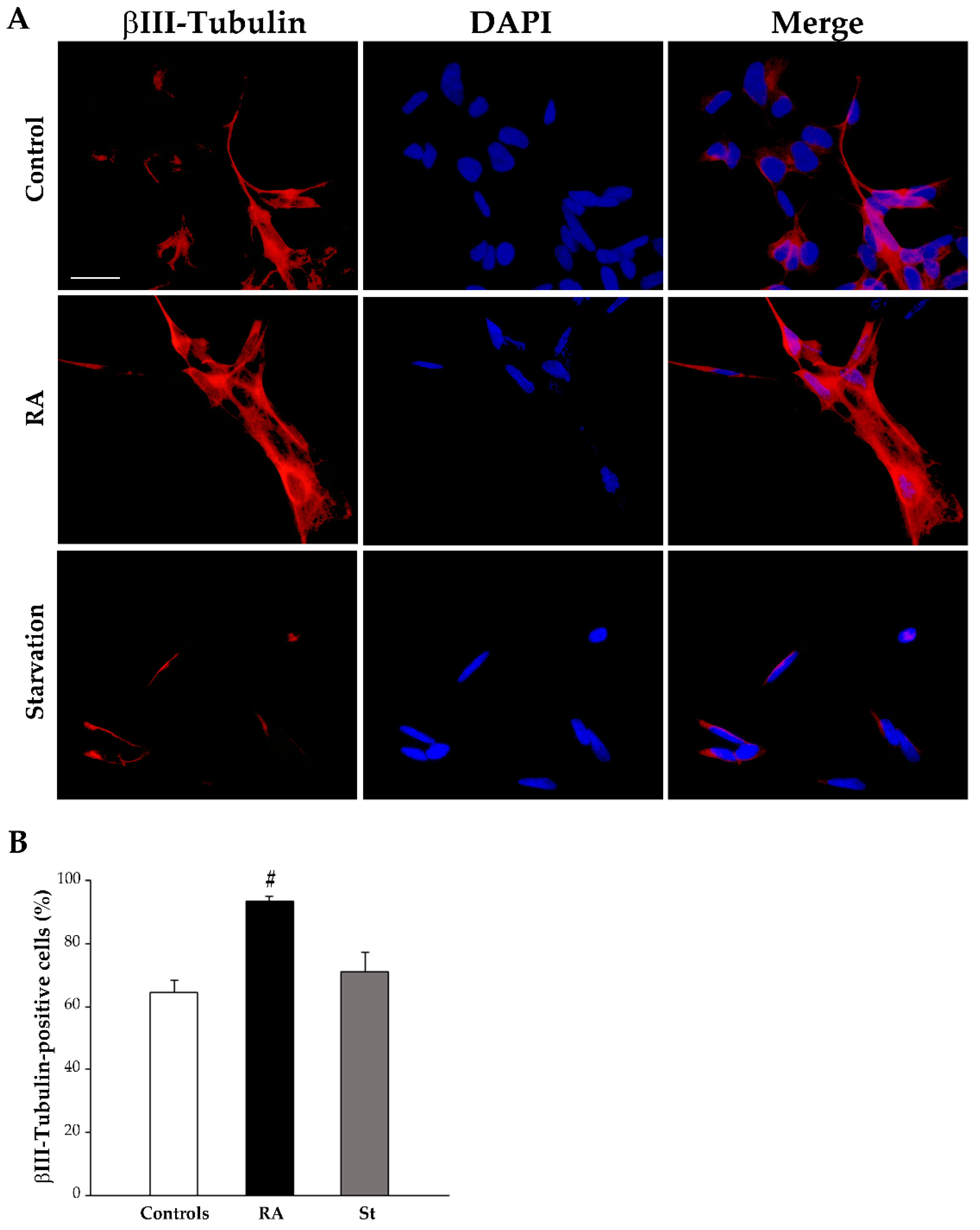 Ijms 26 01691 g009 Ijms 26 01691 g009