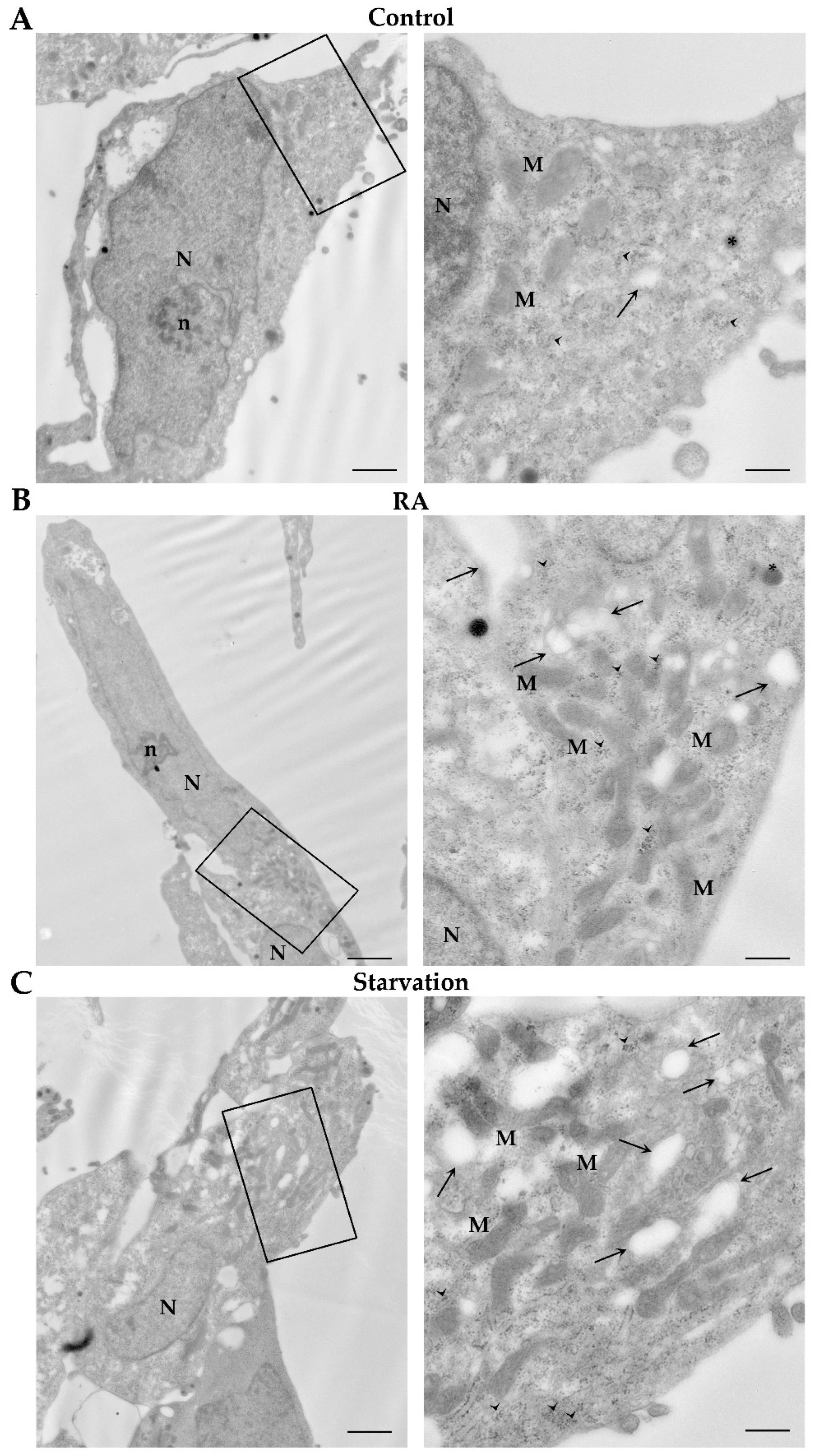 Ijms 26 01691 g012 Ijms 26 01691 g012