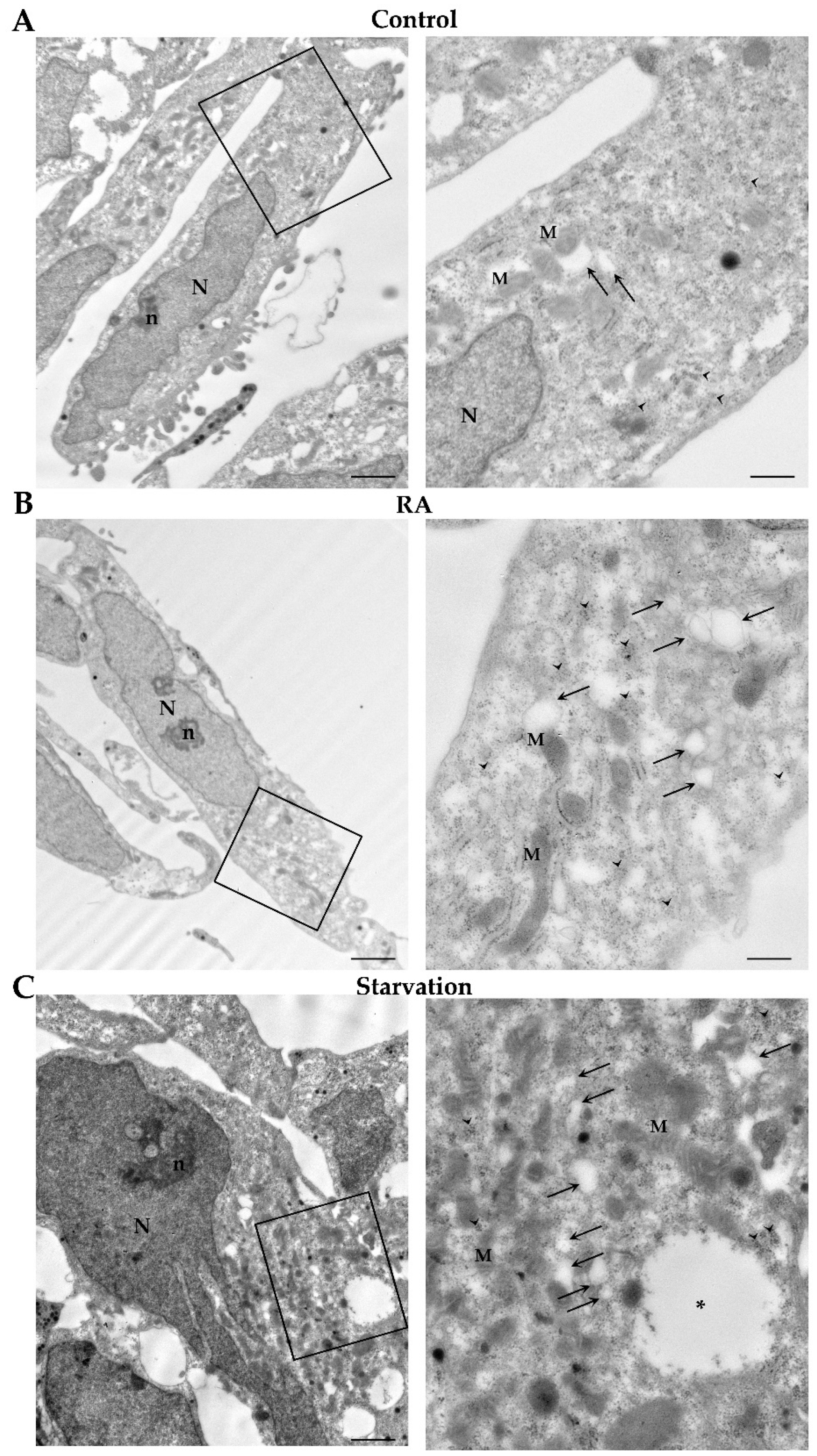 Ijms 26 01691 g013 Ijms 26 01691 g013