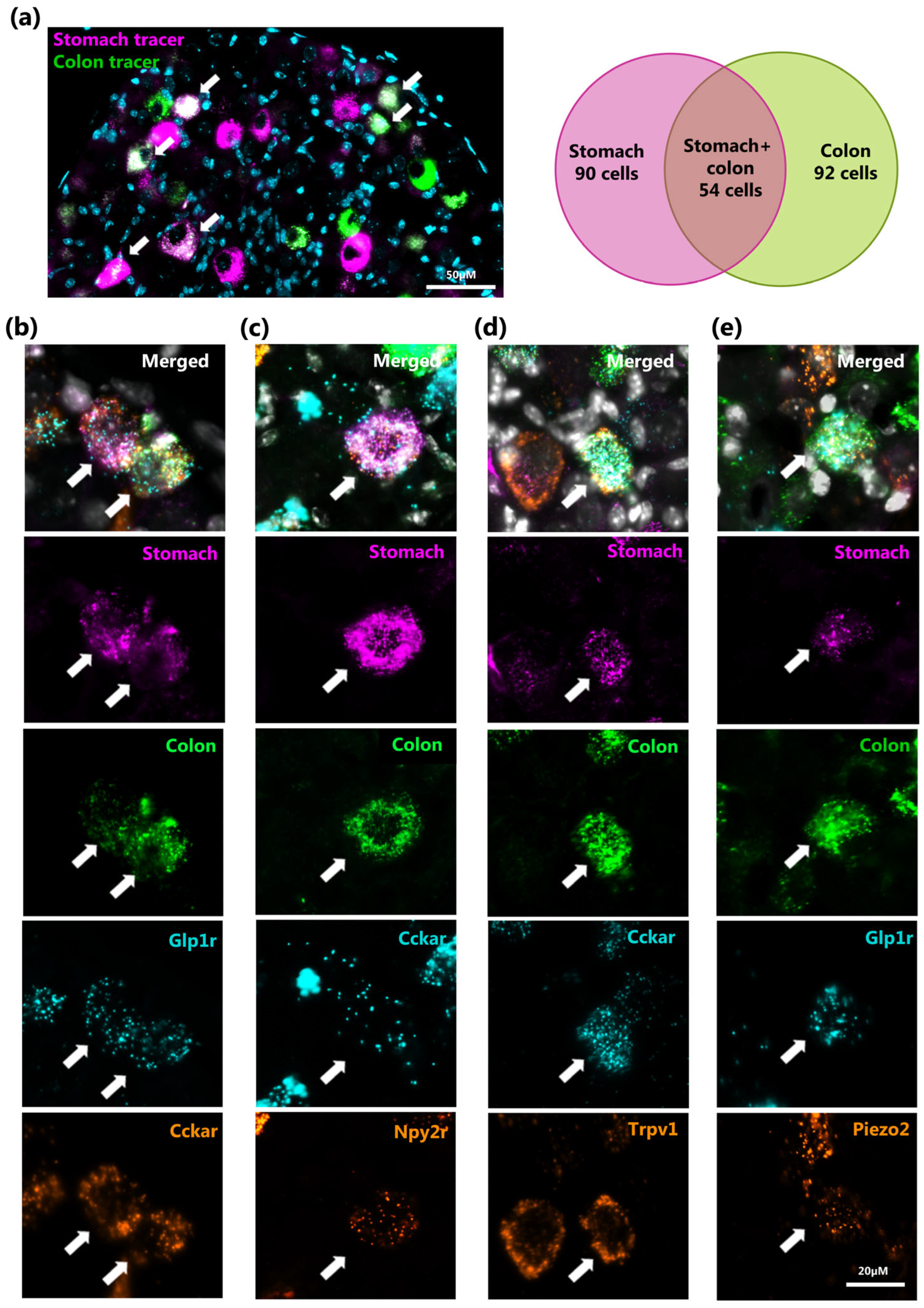 Ijms 26 02053 g005