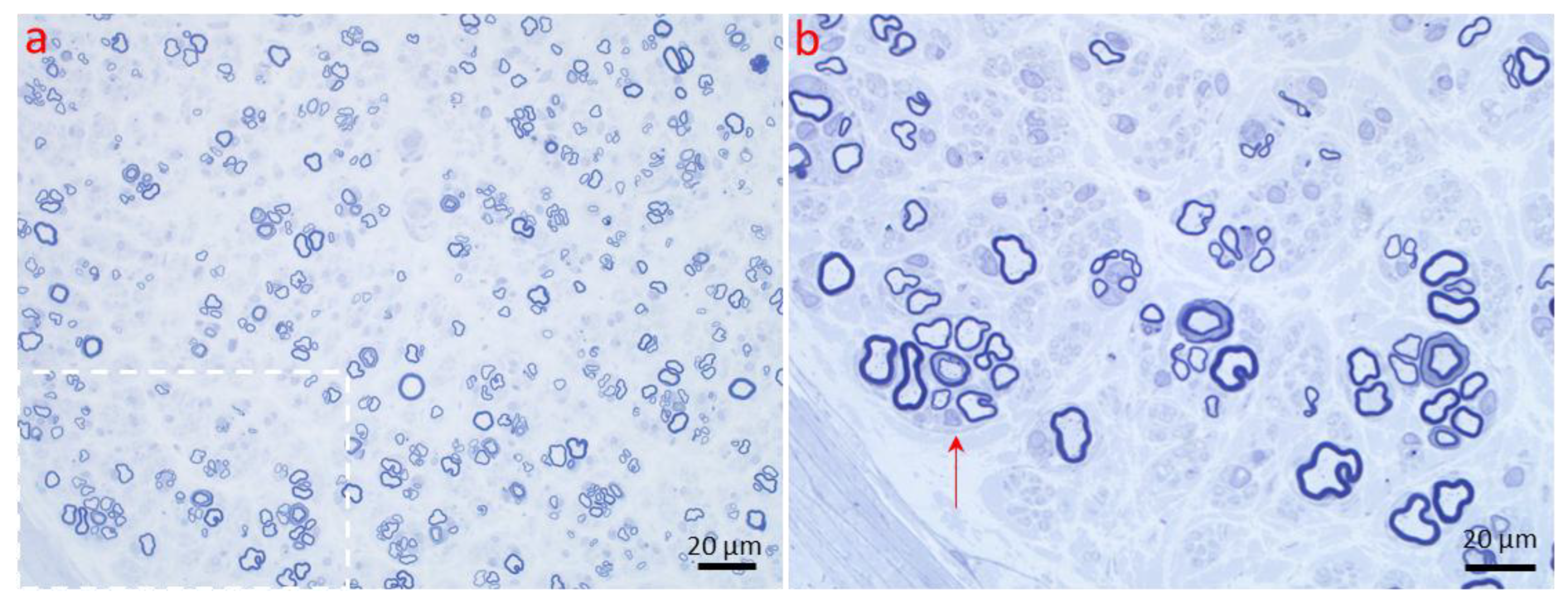 Ijms 26 03377 g006