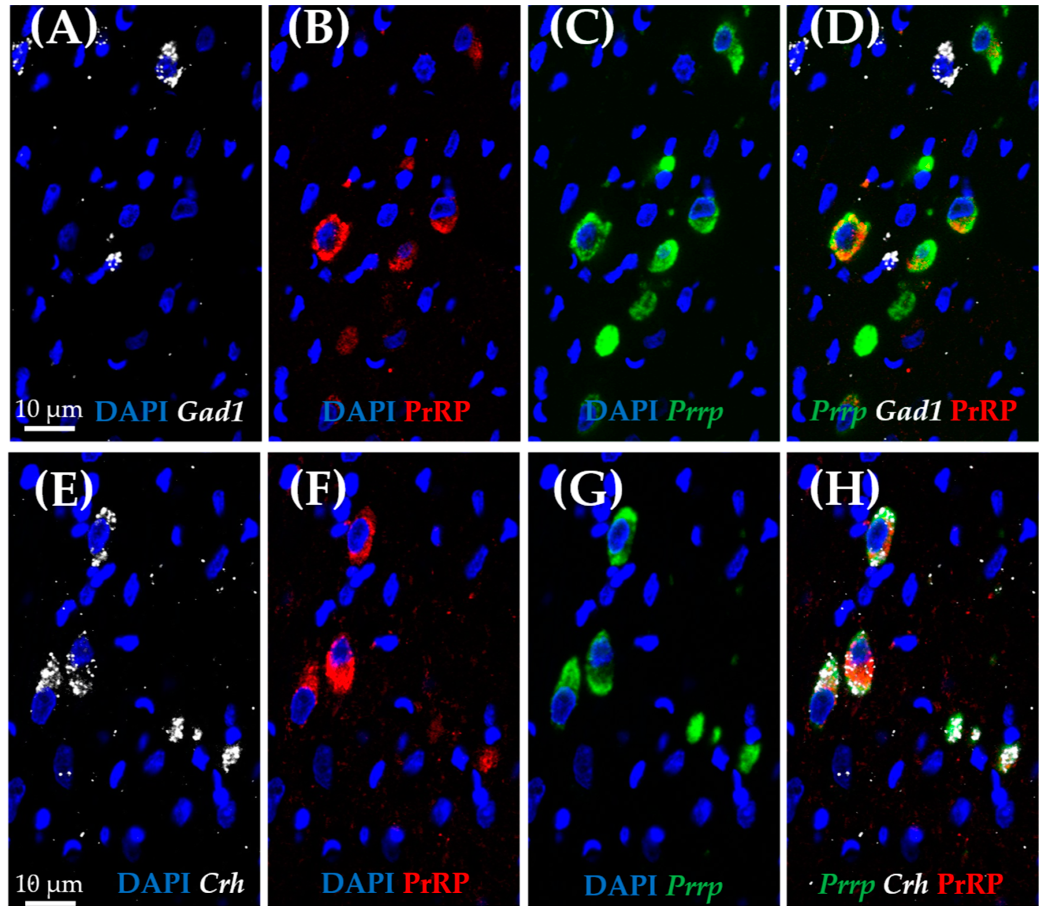 Ijms 26 04155 g006 Ijms 26 04155 g006