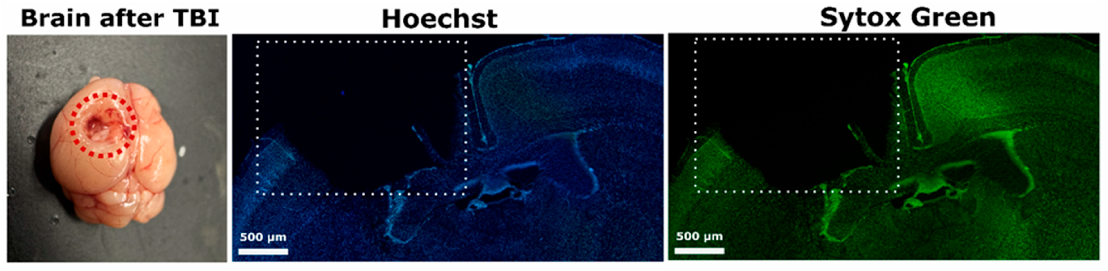 The Role of Hydrogen Sulfide in the Localization and Structural ...