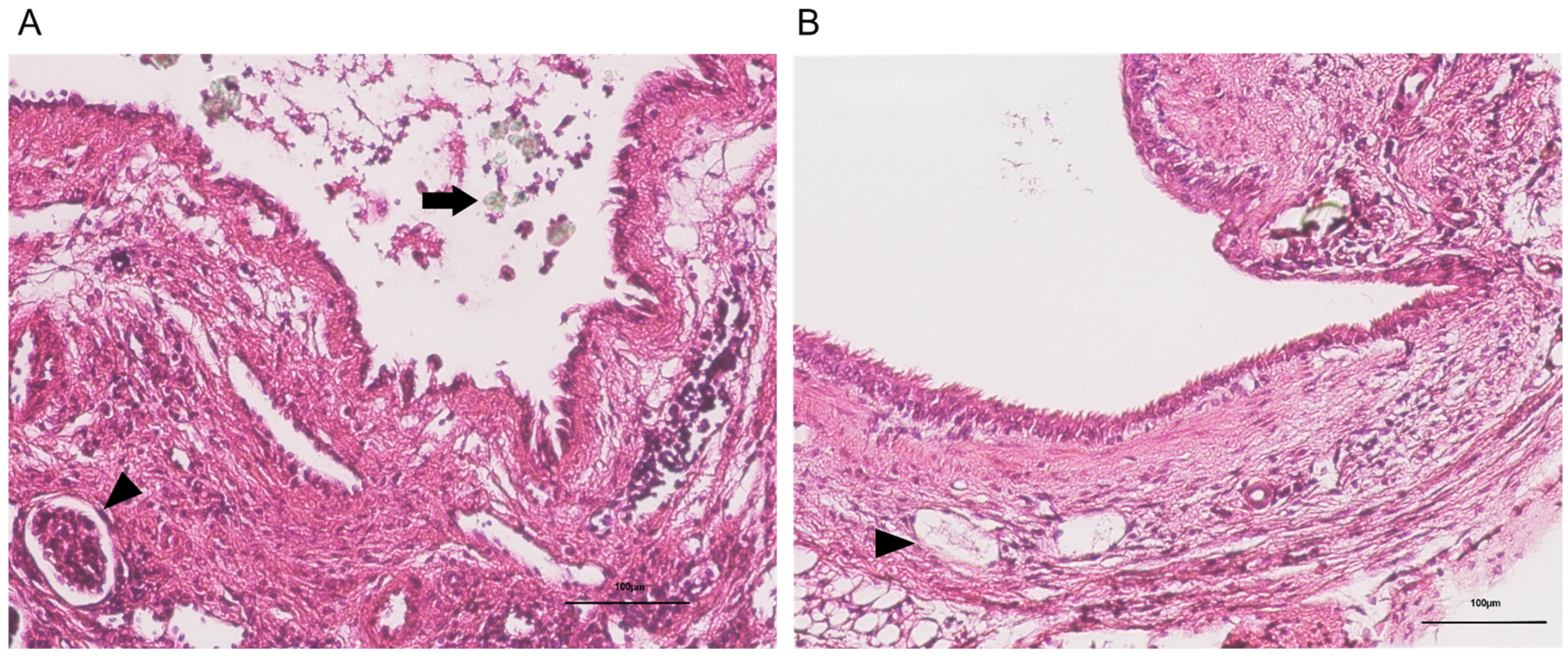 Ijms 26 09117 g004 Ijms 26 09117 g004