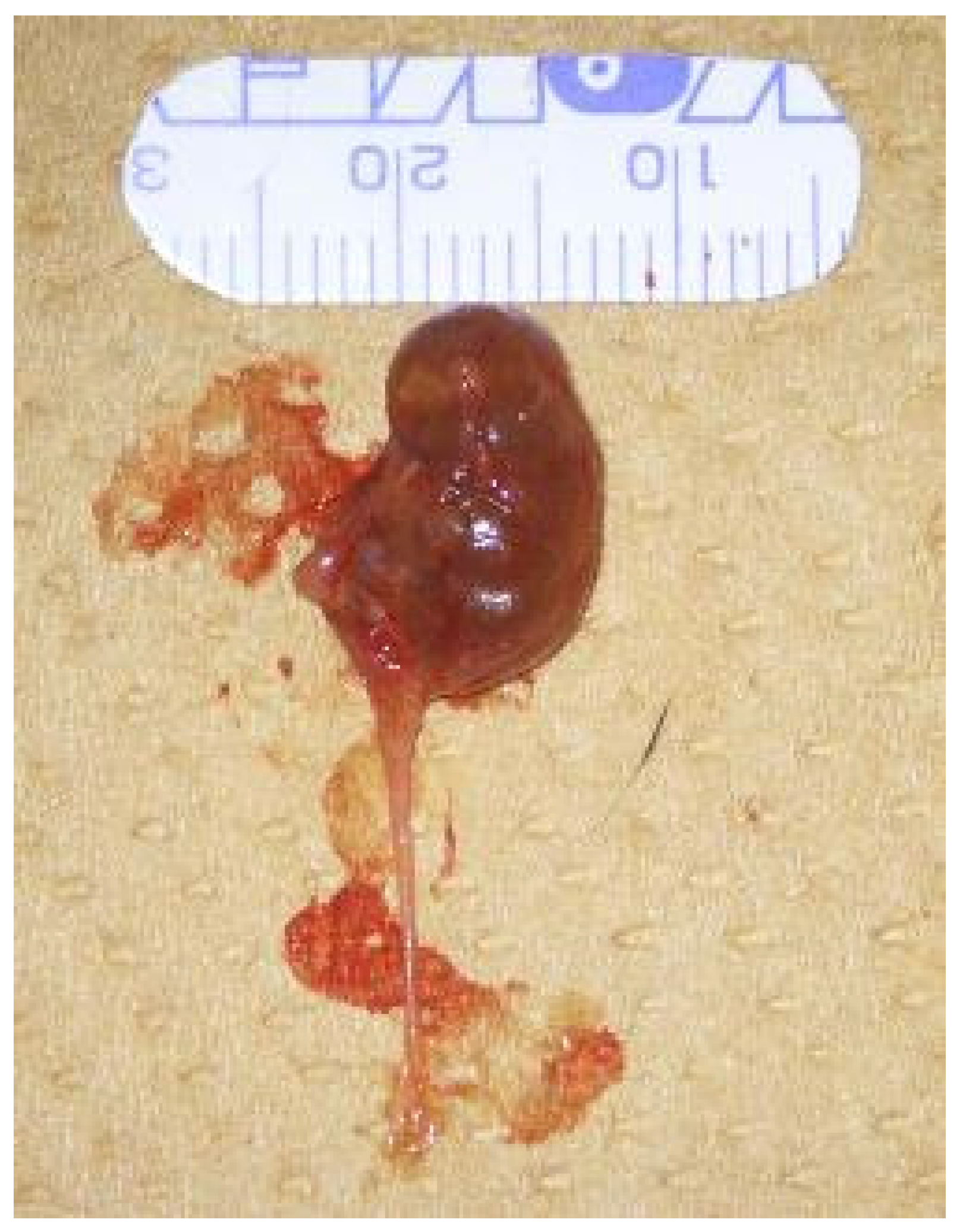 Ijms 26 09117 g011 Ijms 26 09117 g011