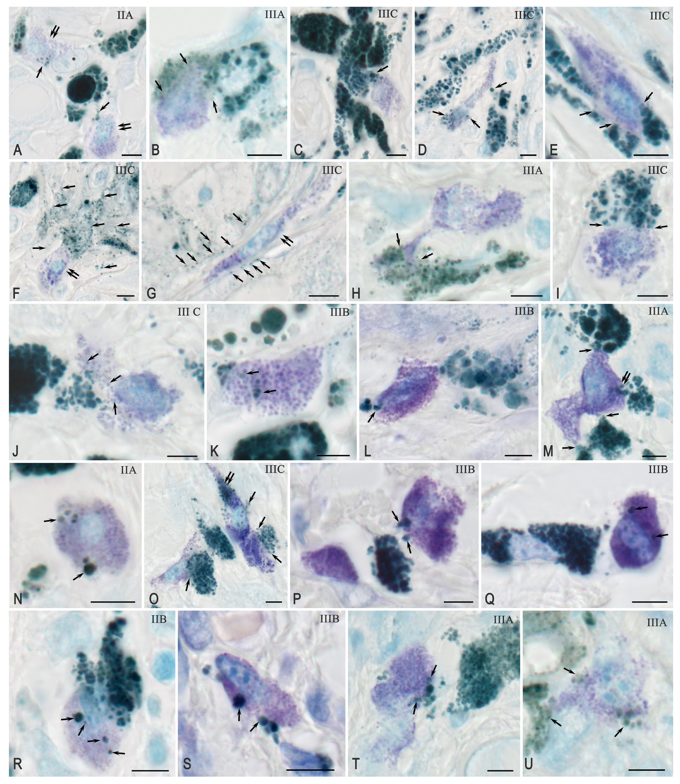 Ijms 26 11313 g003