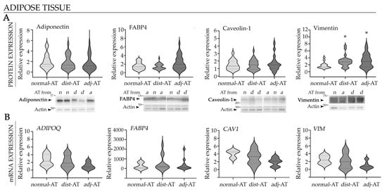 Expression levels of cancer prognostic markers in the breast adipose microenvironment. (A) Representative WB images and quantification of adiponectin, caveolin-1, FABP4, and vimentin in normal, adjacent and distant breast AT explants. Images were analyzed by densitometry. Arrows indicate the specific protein bands quantified: adiponectin band (~30 kDa), caveolin-1 doublet (~21–24 kDa), FABP4 (~16 kDa), vimentin doublet (~58 kDa), and actin (~43 kDa). Quantification values were normalized to the corresponding loading control and represented as violin plots, where the dashed (bold) line indicates the median and dotted lines represent the first and the third quartiles (N = 2). (B) The mRNA levels of ADIPOQ, FABP4, CAV1, and VIM from different AT explants were analyzed by RT-qPCR. Values were normalized to reference genes and represented as violin plots (N = 2). Adipose explants used in WB assay: nnormal-AT = 9, nadacentj-AT = 20 and ndistant-AT = 17; Adipose explants used in qPCR assay: nnormal-AT = 4, nadacentj-AT = 13 and ndistant-AT = 15. Statistical analysis was performed by one-way ANOVA followed by Tukey’s post hoc test; * p < 0.05 compared to normal AT. Adjacent breast explants (AT < 2 cm from the tumor); distant breast explants (AT > 2 cm from the tumor); n, a and d in blots represent lanes in which protein lysates from normal, adjacent and distant explants were seeded, respectively.