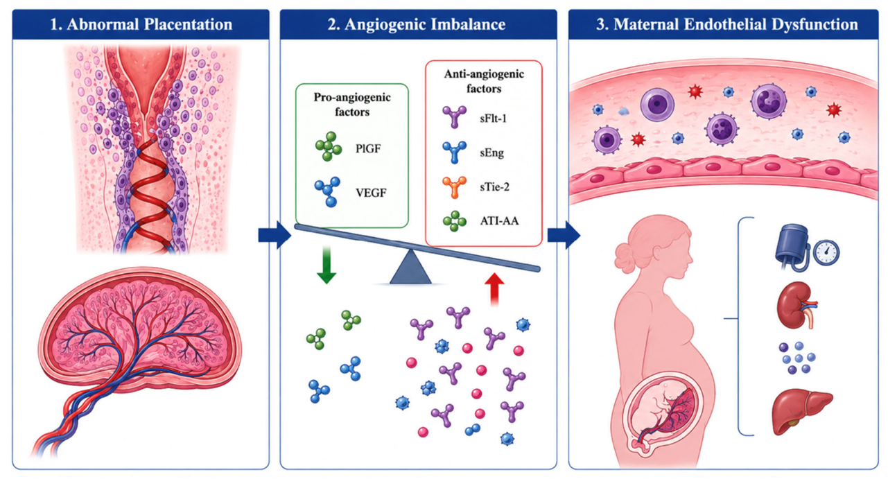 Angiogenic Imbalance in Early Placental Dysfunction: Pro- and Anti ...