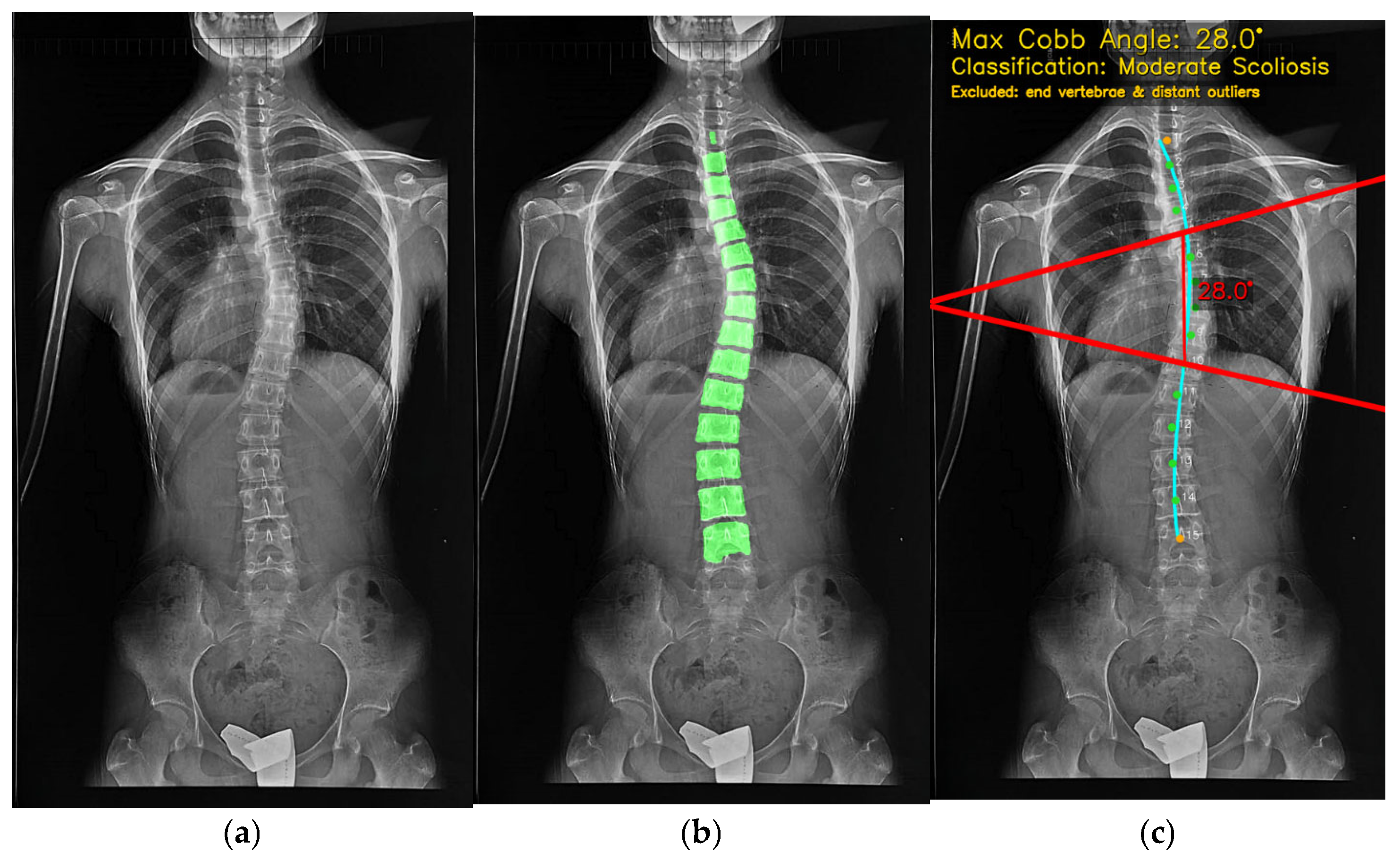 Informatics 12 00140 g013 Informatics 12 00140 g013